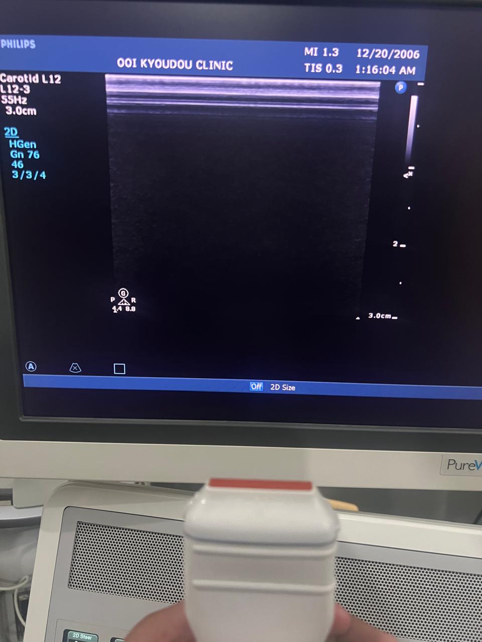 ..Philips L12-3 linear probe