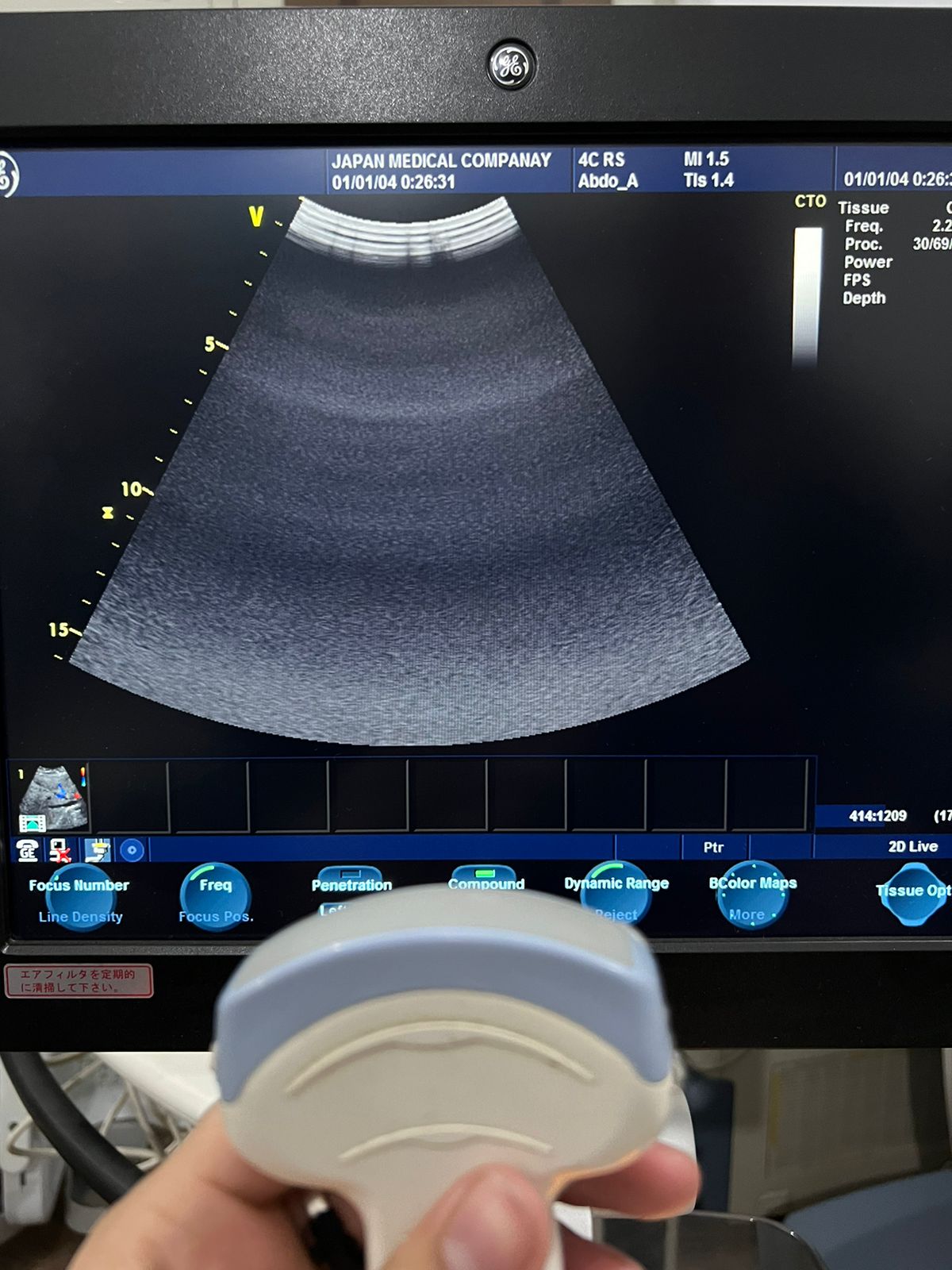 ..GE 4C RS Probe number 18