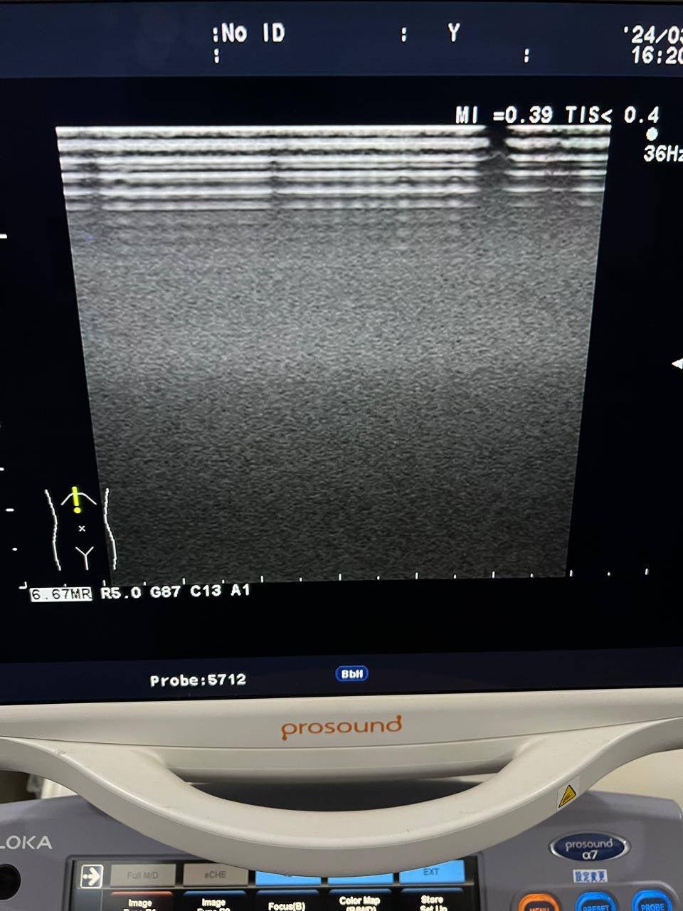 ..Hitachi UST-5712 linear vascular probe - Japan Medical Company LTD