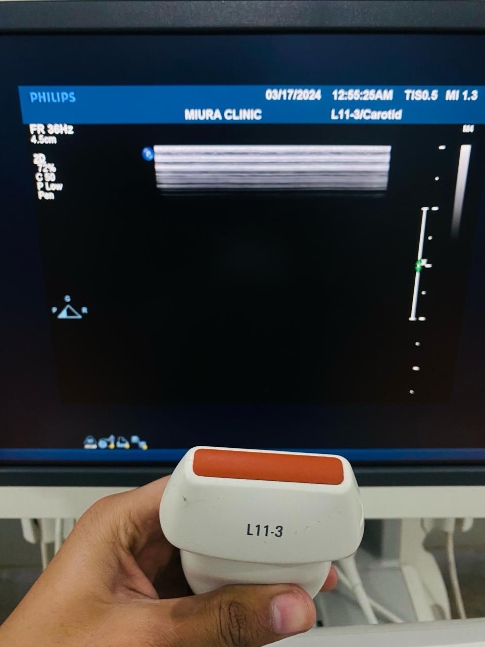 ..Philips L11-3 linear probe