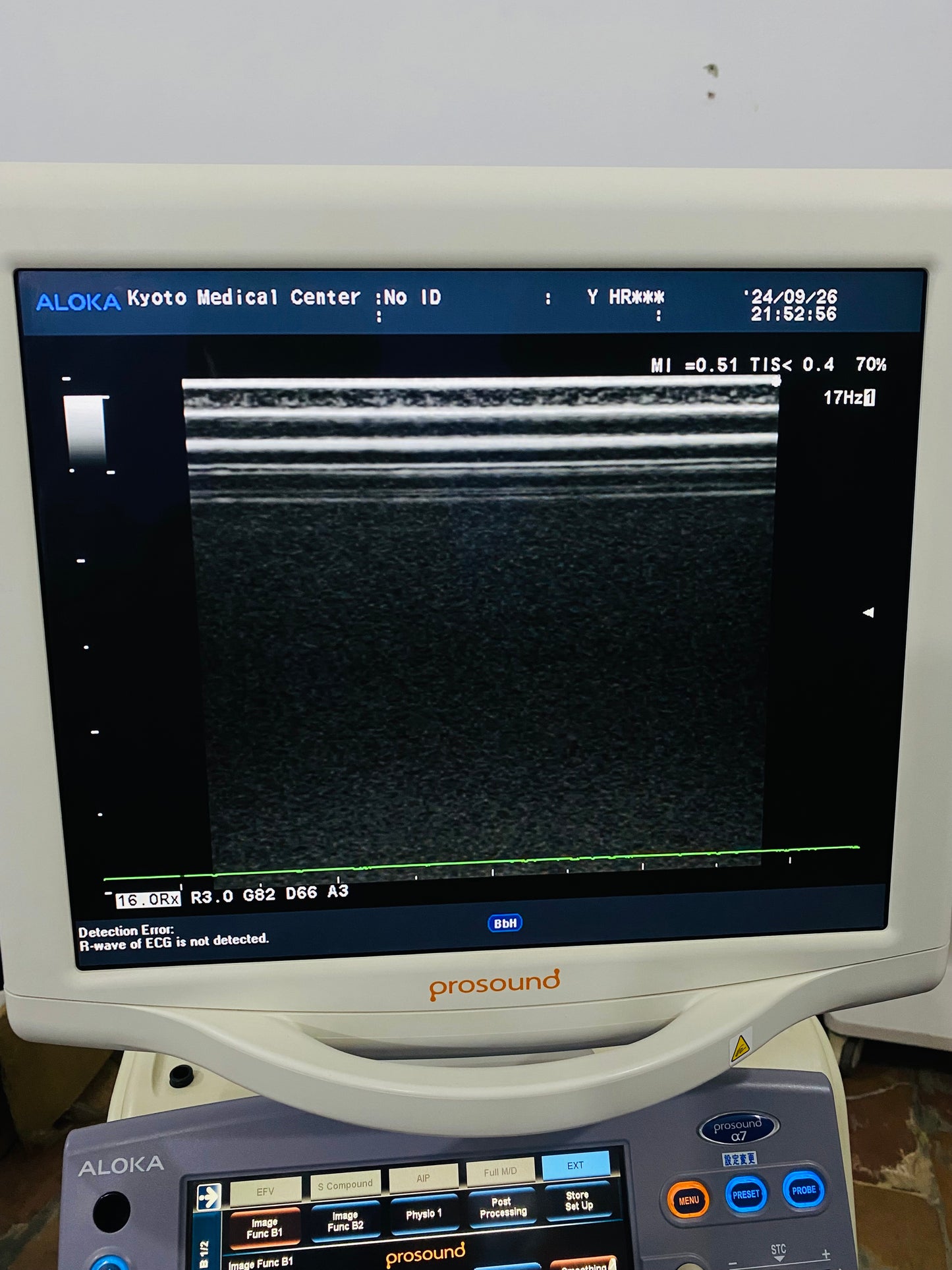 P..Aloka UST-5412 linear probe