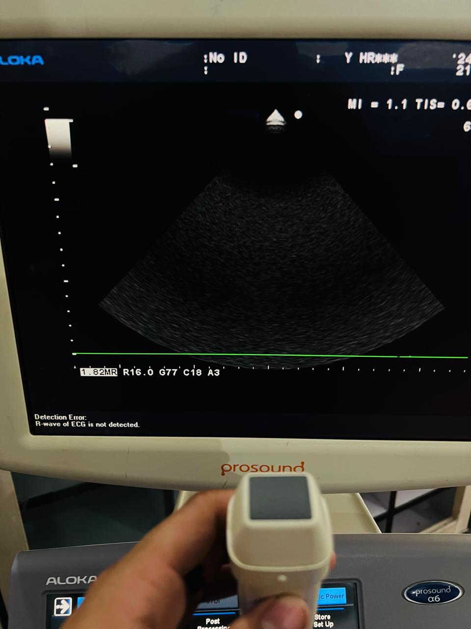 ..Aloka UST-5299 cardiac probe