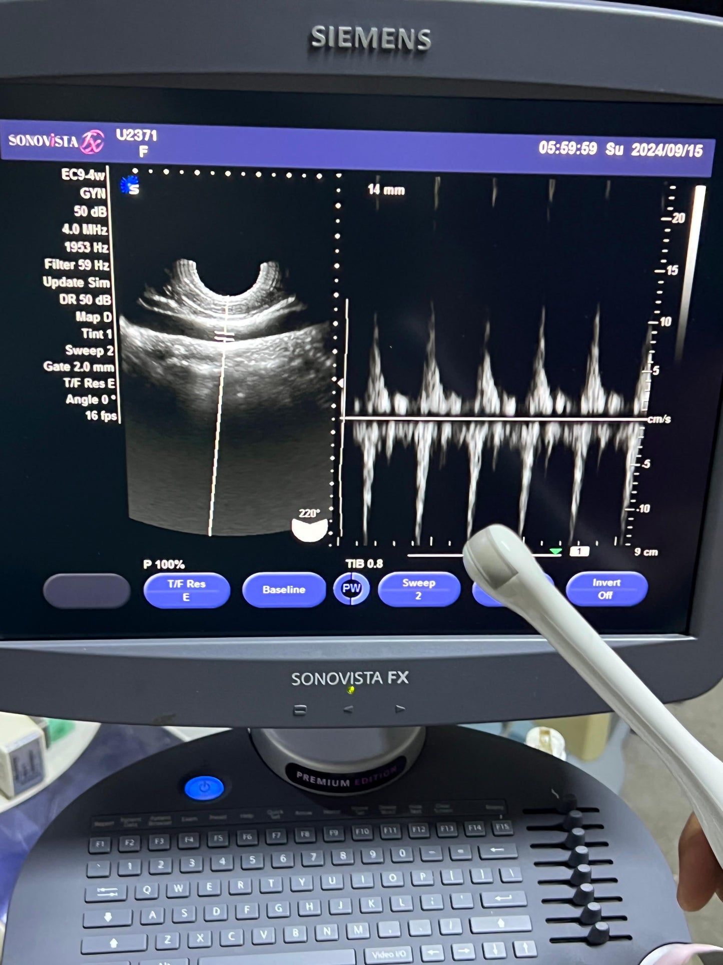 Sonovista FX Premium edition black and white ultrasound with convex tvs probe