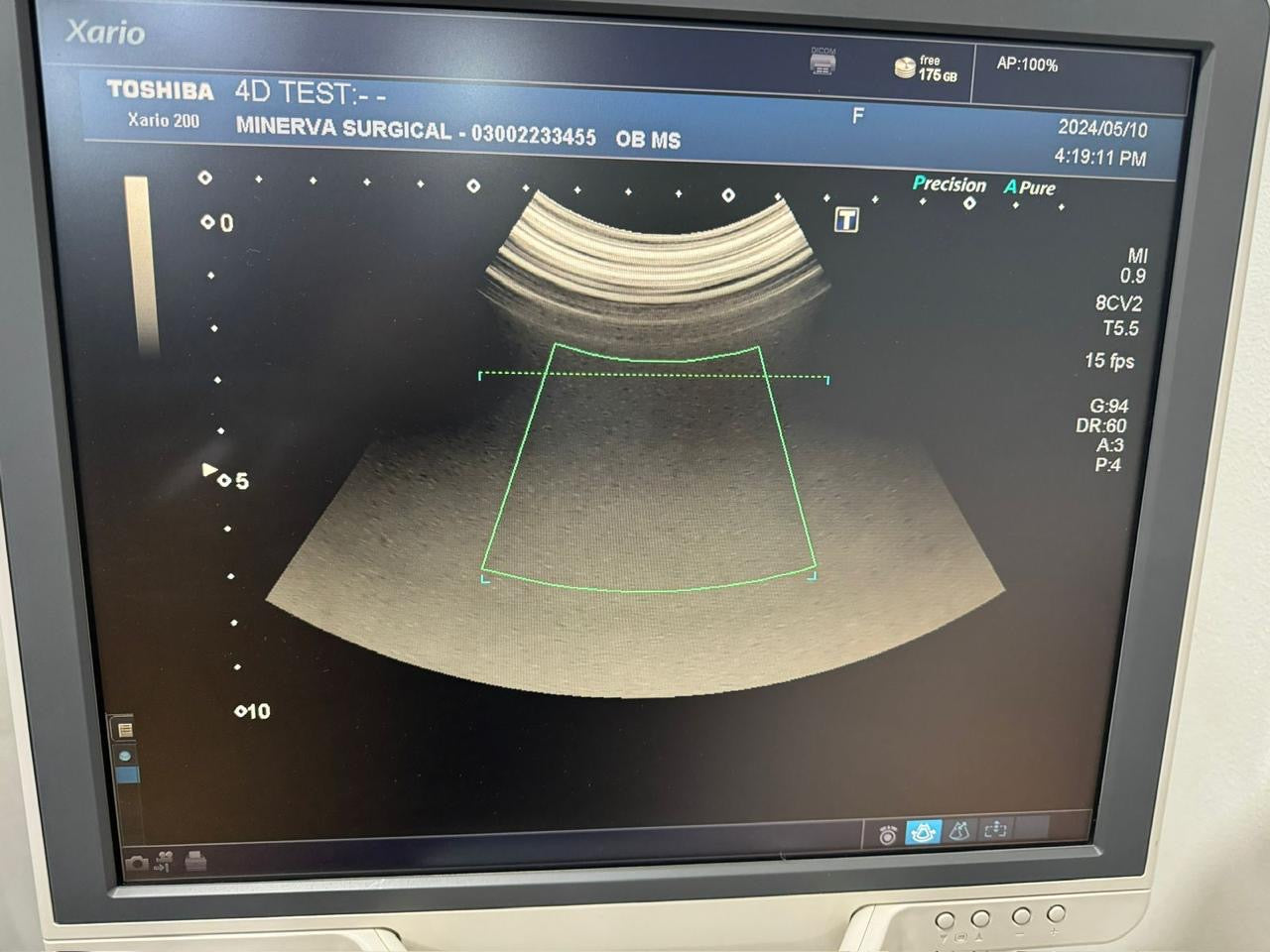 TOSHIBA PVU-674MV / 8CV2
CURVED PROBE