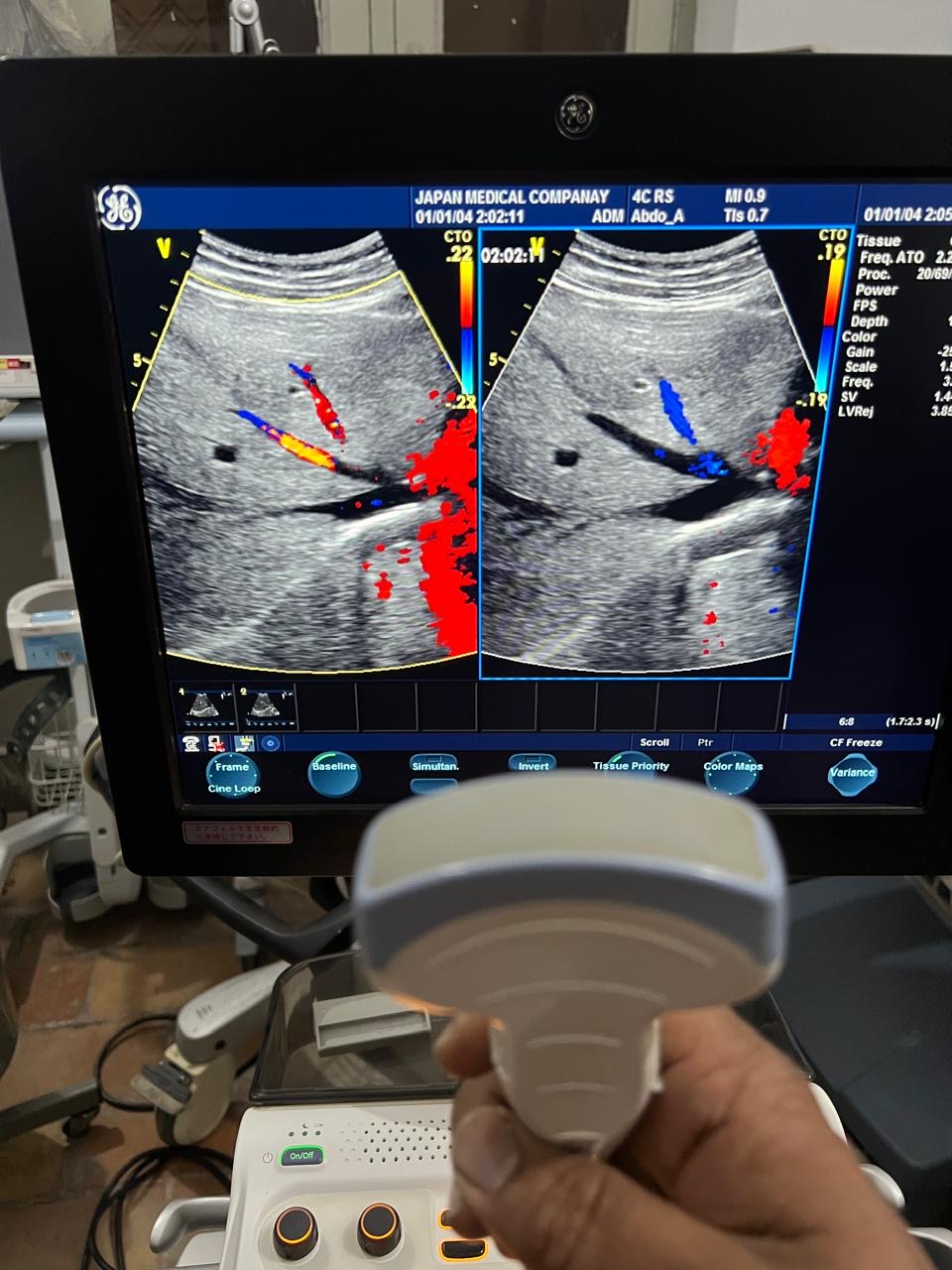 ..GE 4C RS Probe Av num (26)