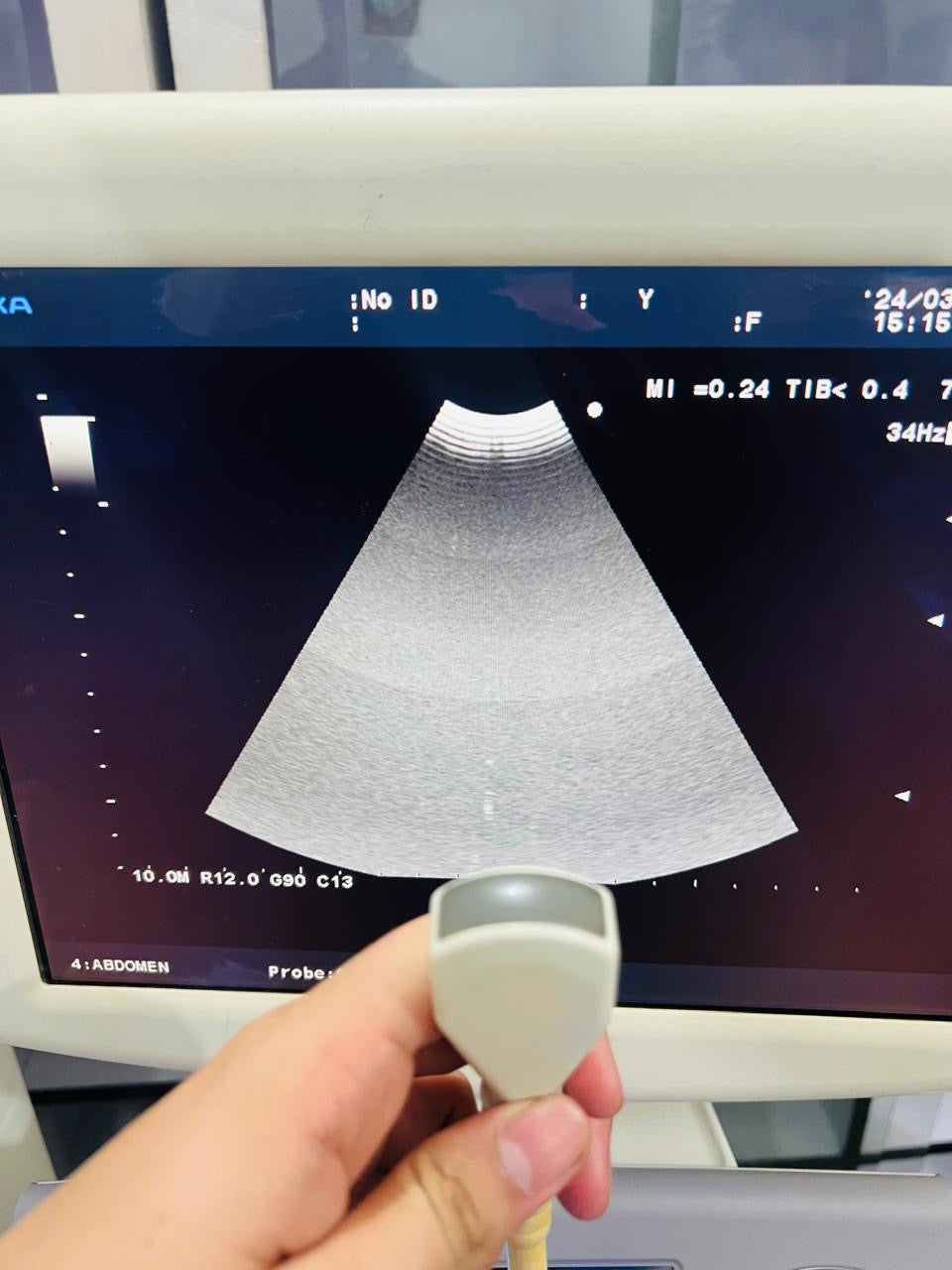 ..Aloka UST-987-7.5 Microconvex probe