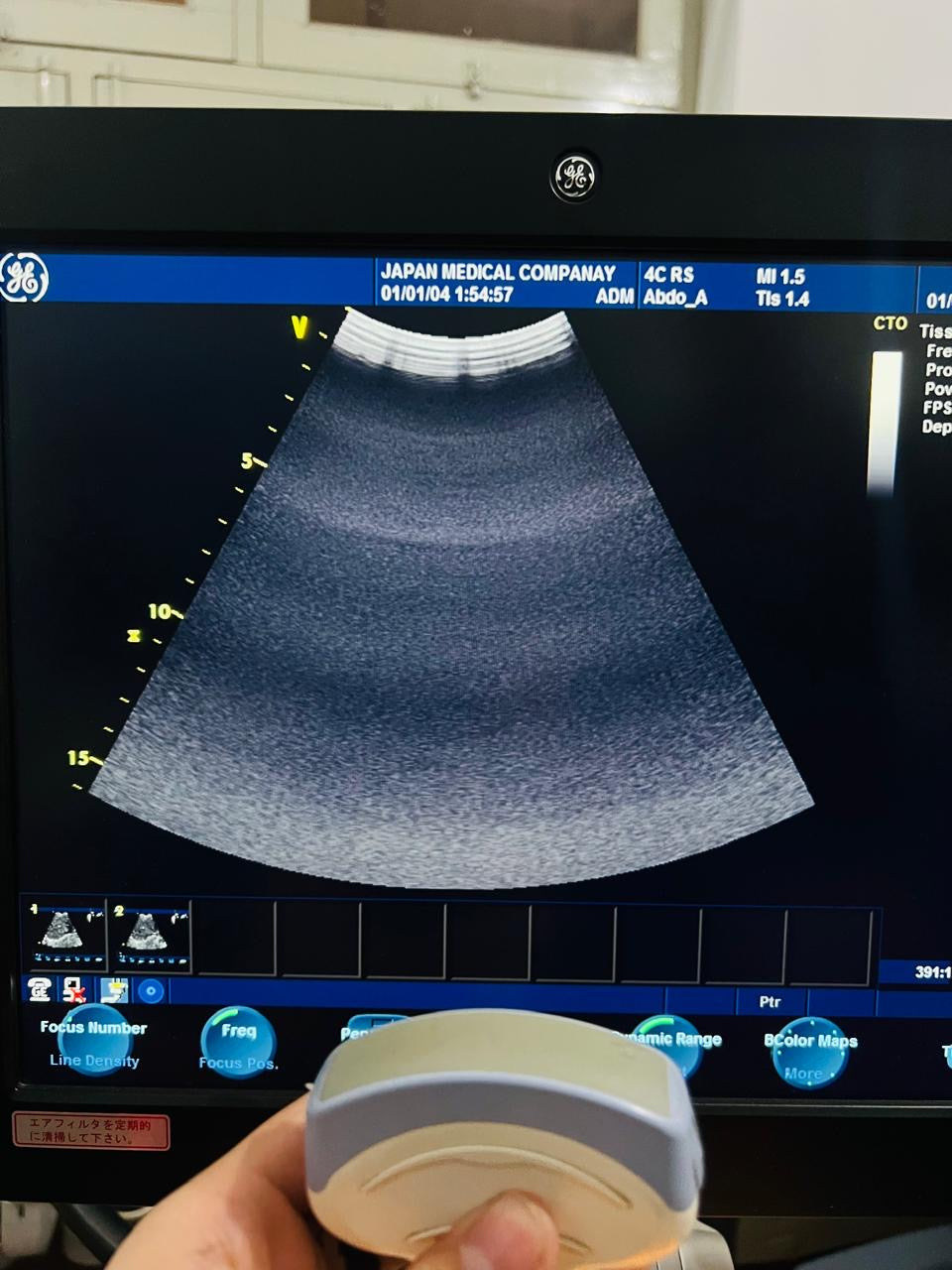 GE 4C RS Probe num 9