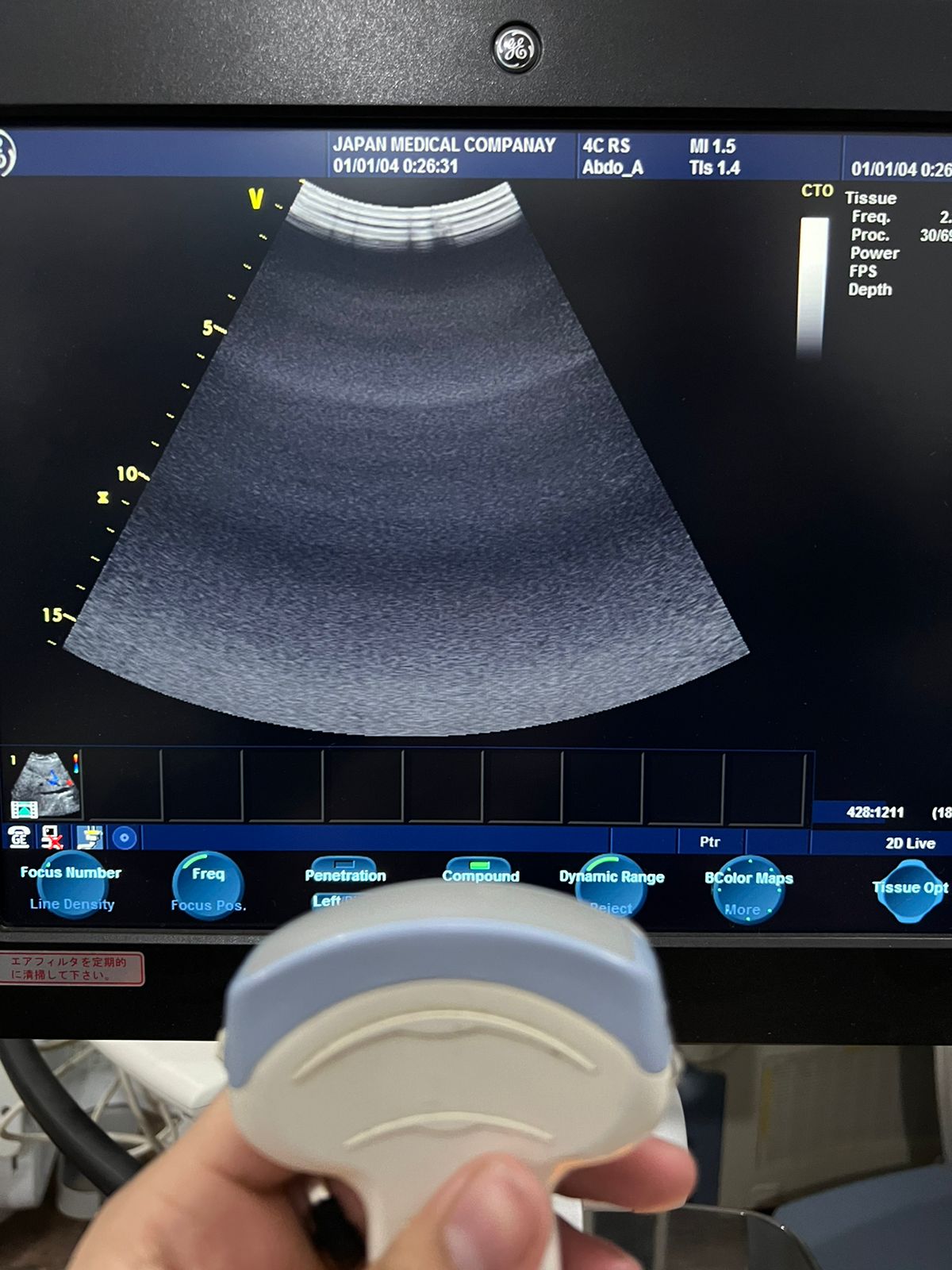 ..GE 4C RS Probe number 18