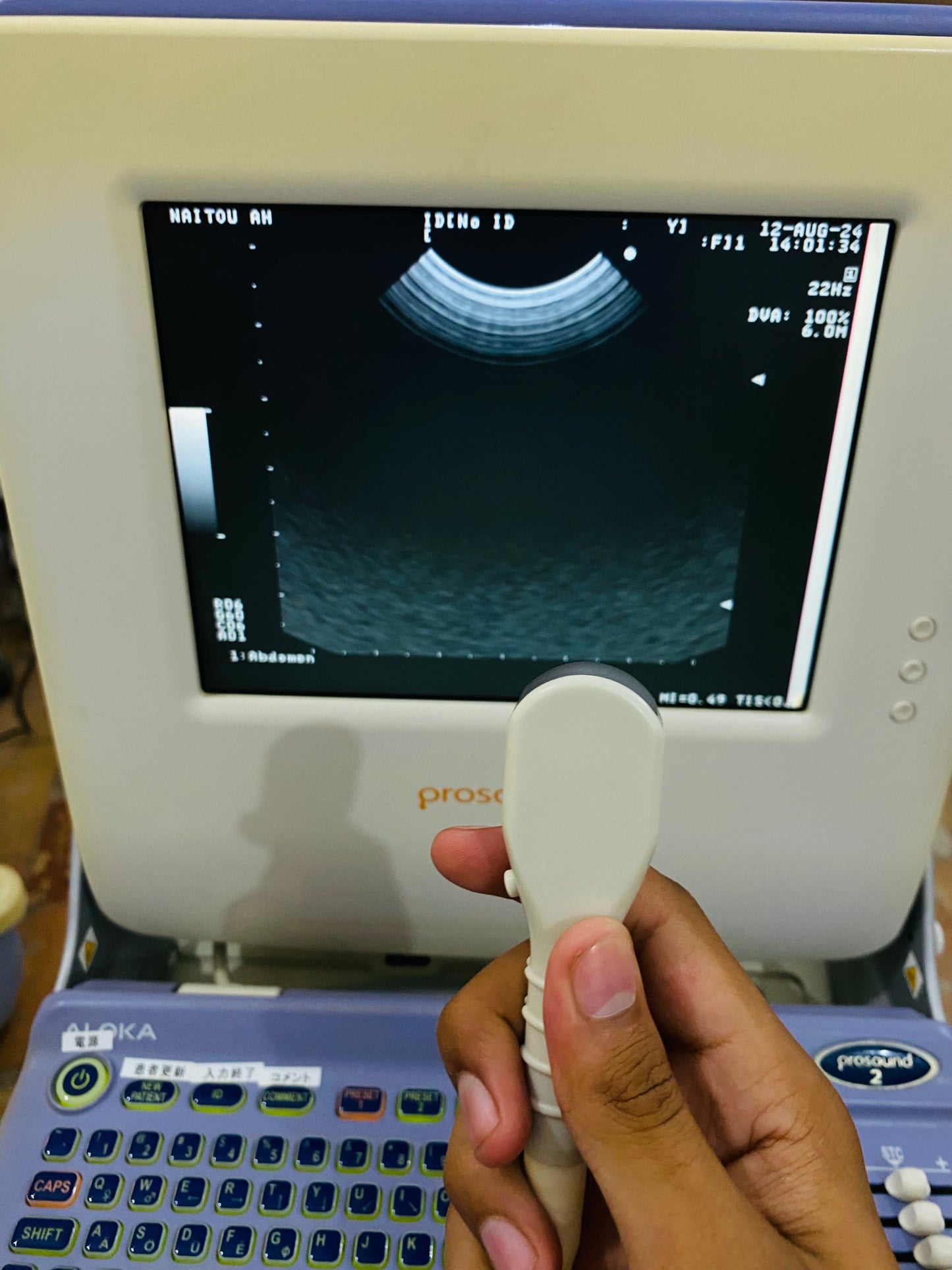 P..Aloka UST-9111-5 Micro convex probe