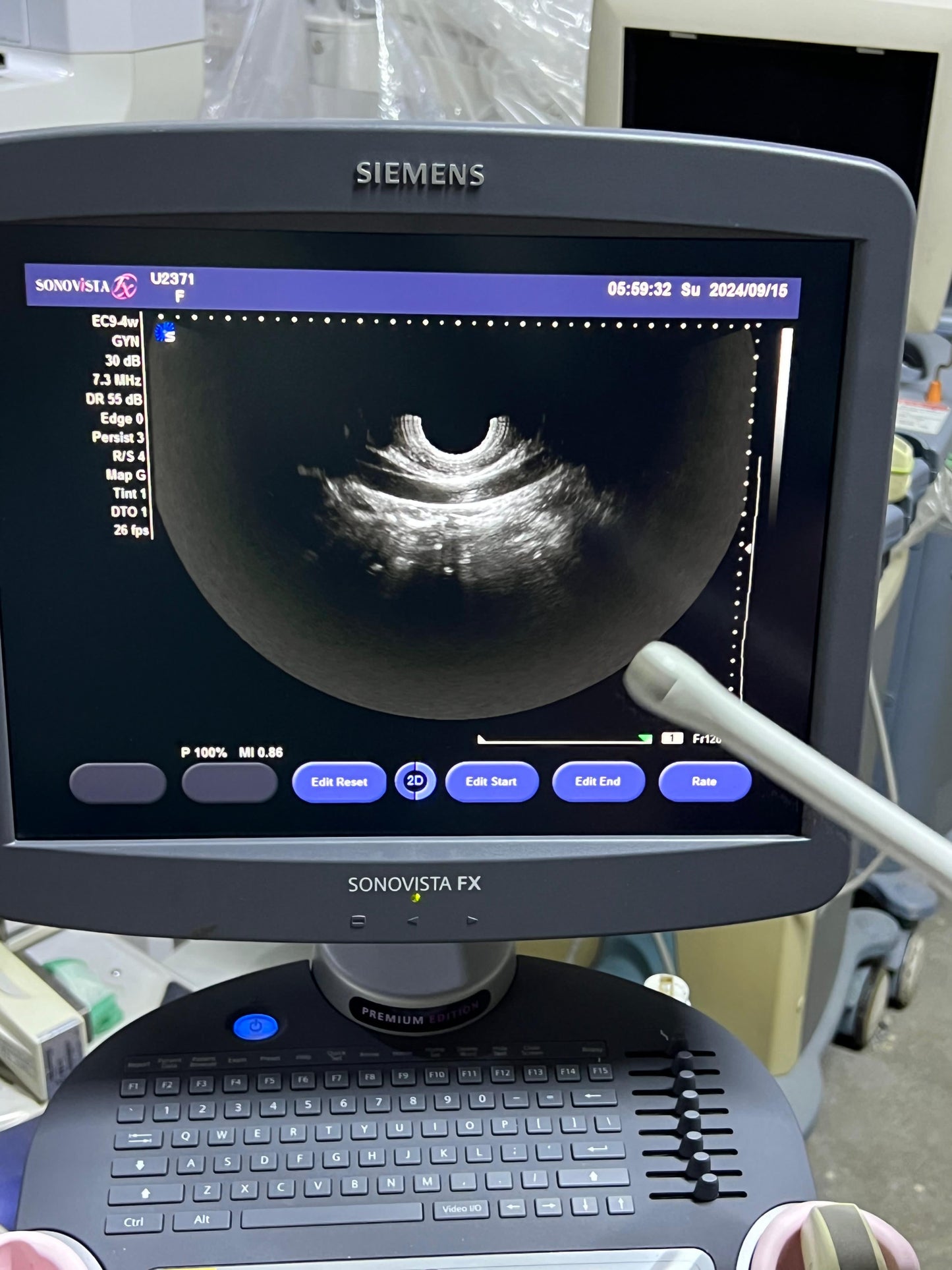 Sonovista FX Premium edition black and white ultrasound with convex tvs probe