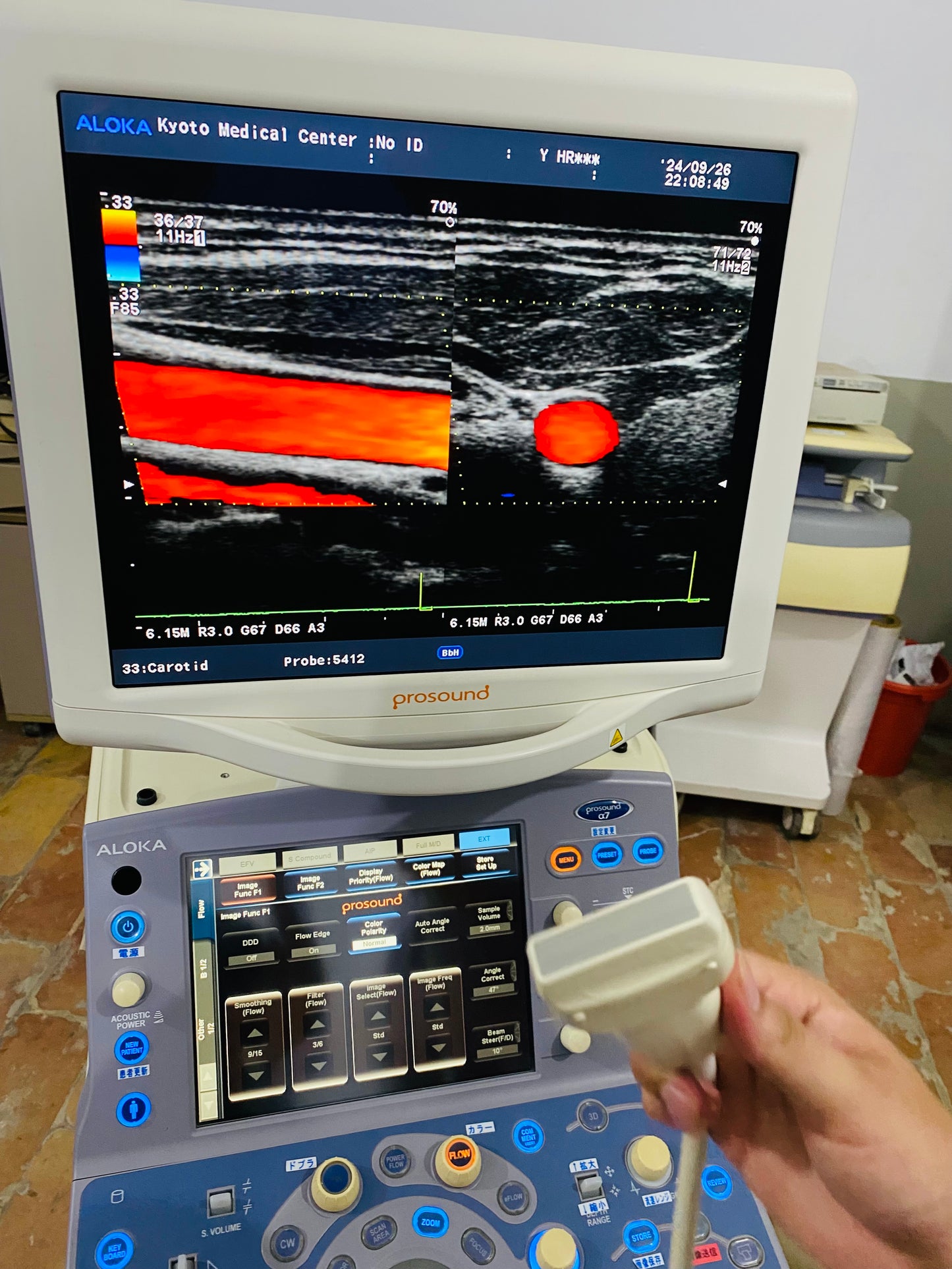 P..Aloka UST-5412 linear probe