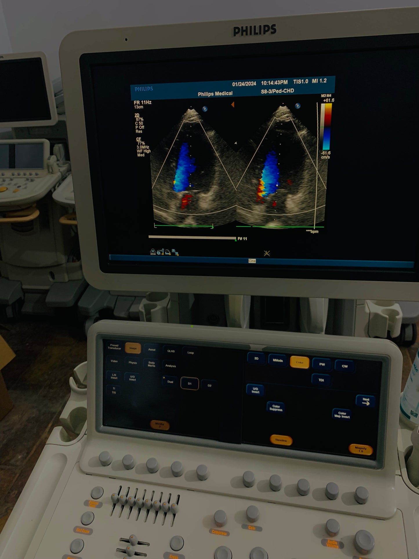 Philips IE 33 Ultrasound Machine
