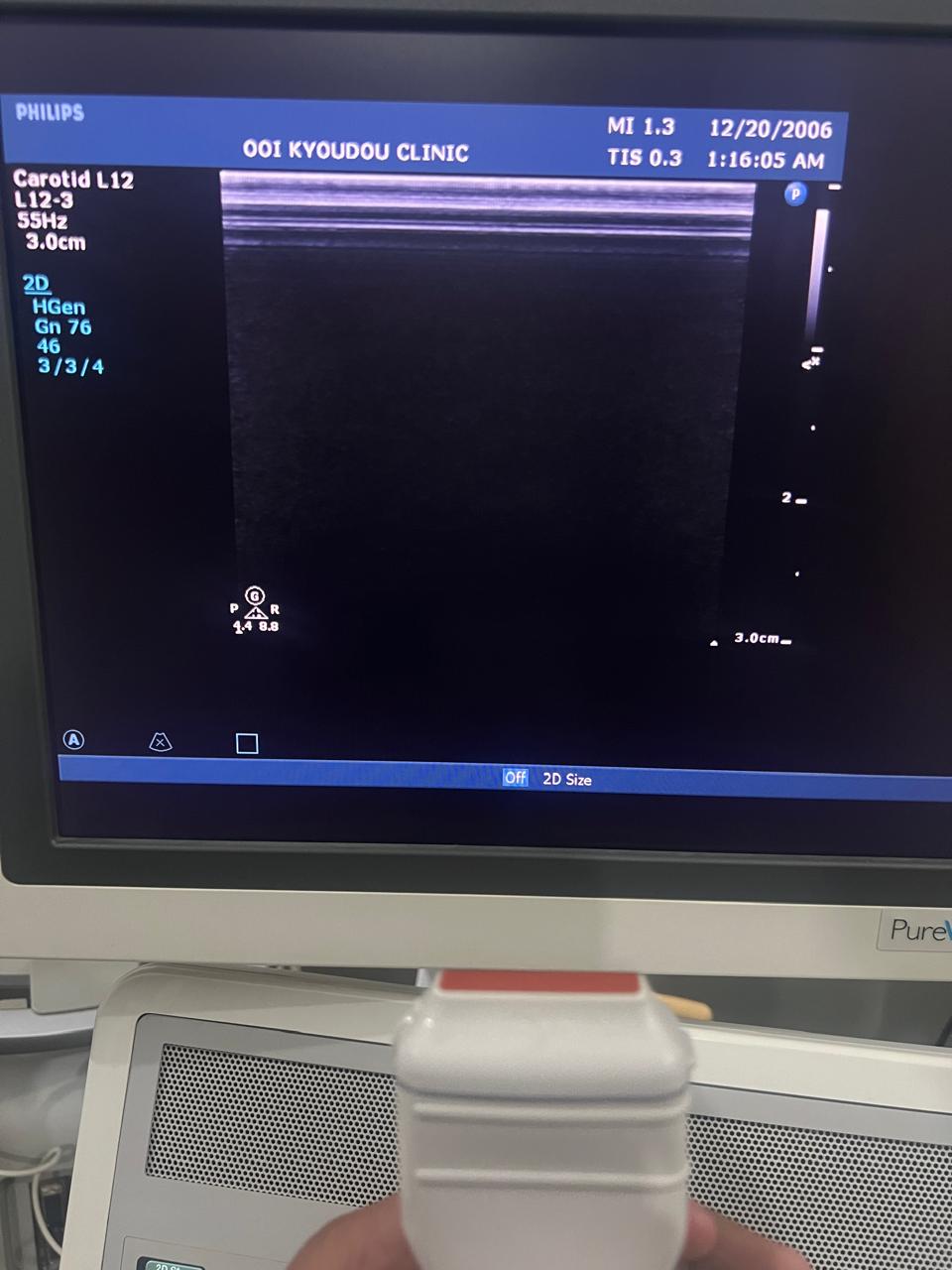 ..Philips L12-3 linear probe