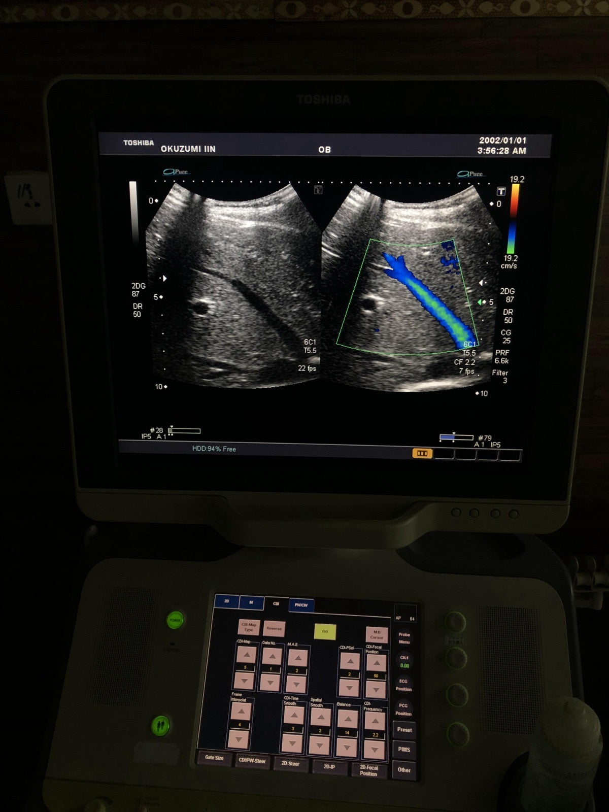 Toshiba PVT-375BT Canvex probe - Japan Medical Company LTD
