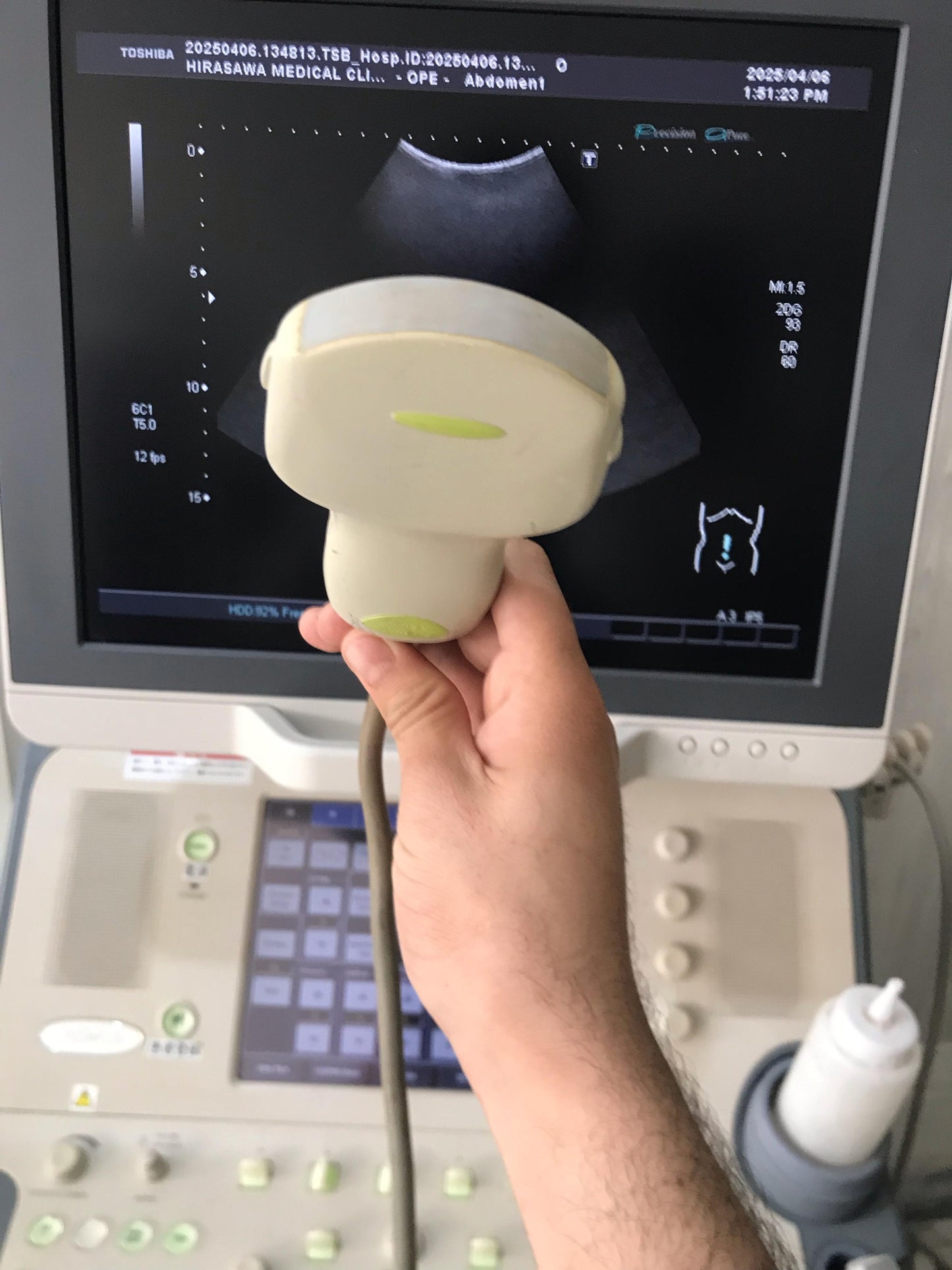 ...Toshiba PVT-375BT Convex Probe