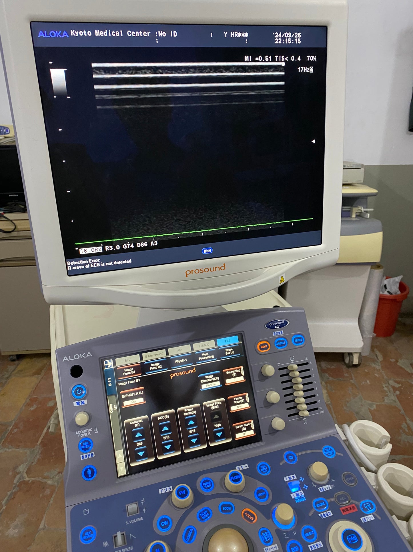 P..Aloka UST-5412 linear probe