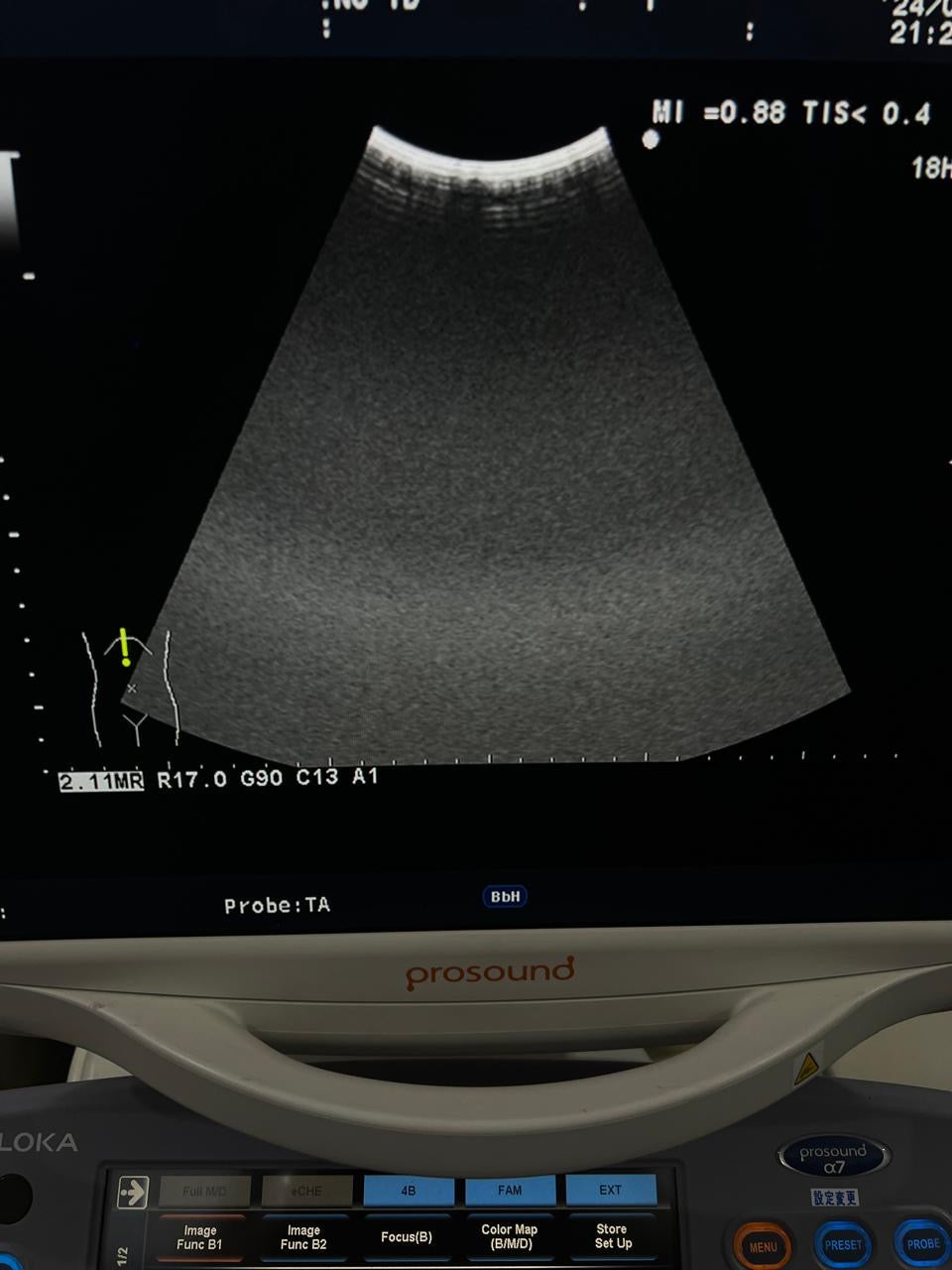 ..Aloka UST-9130 convex probe checked dxb
