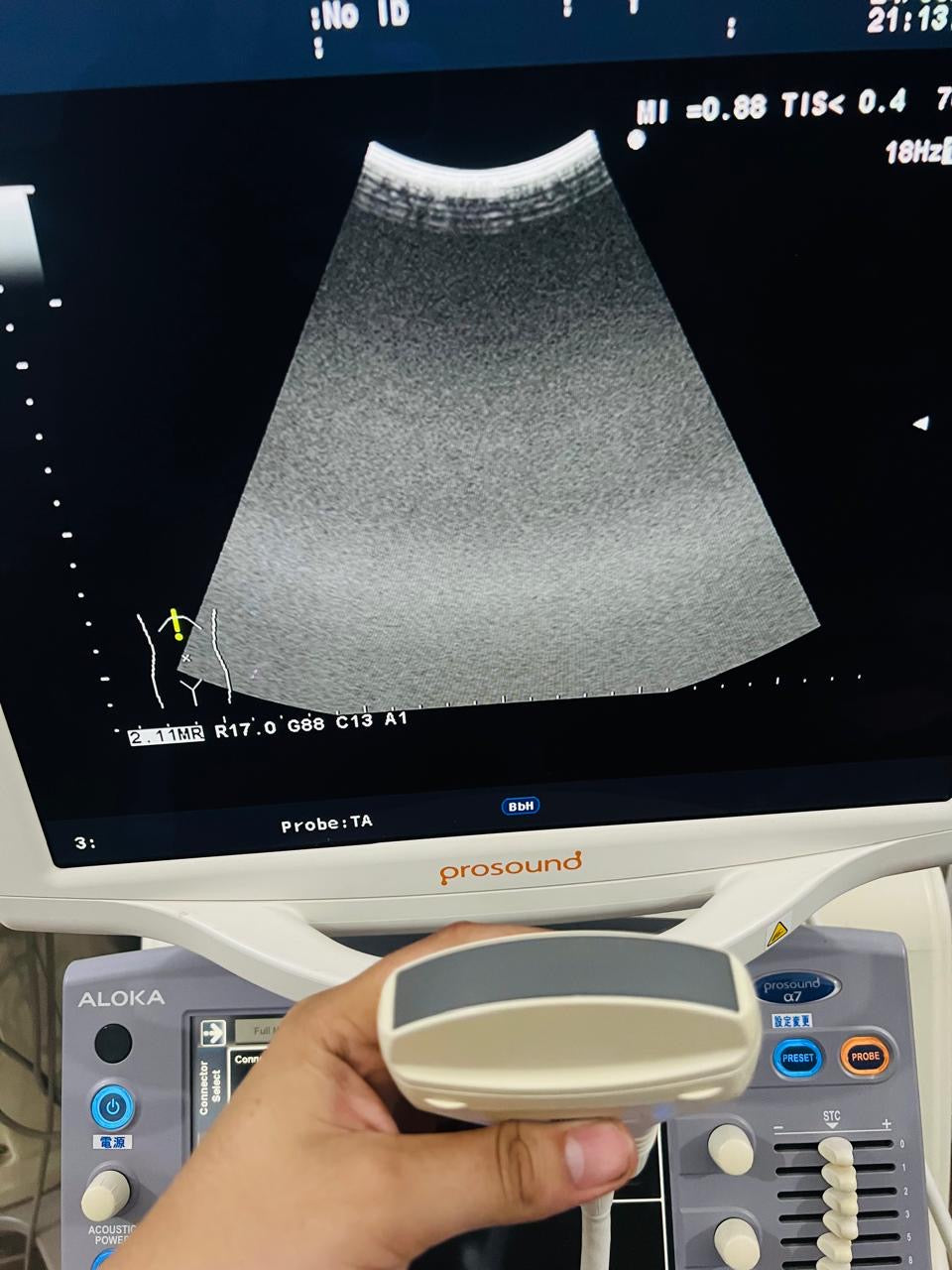 ..Aloka UST-9130 convex probe sn.x0024095 checked DXB