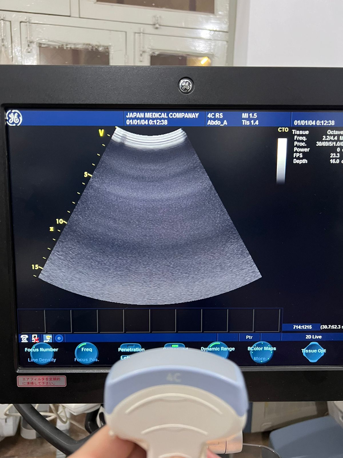 ..GE 4C RS probe num 15