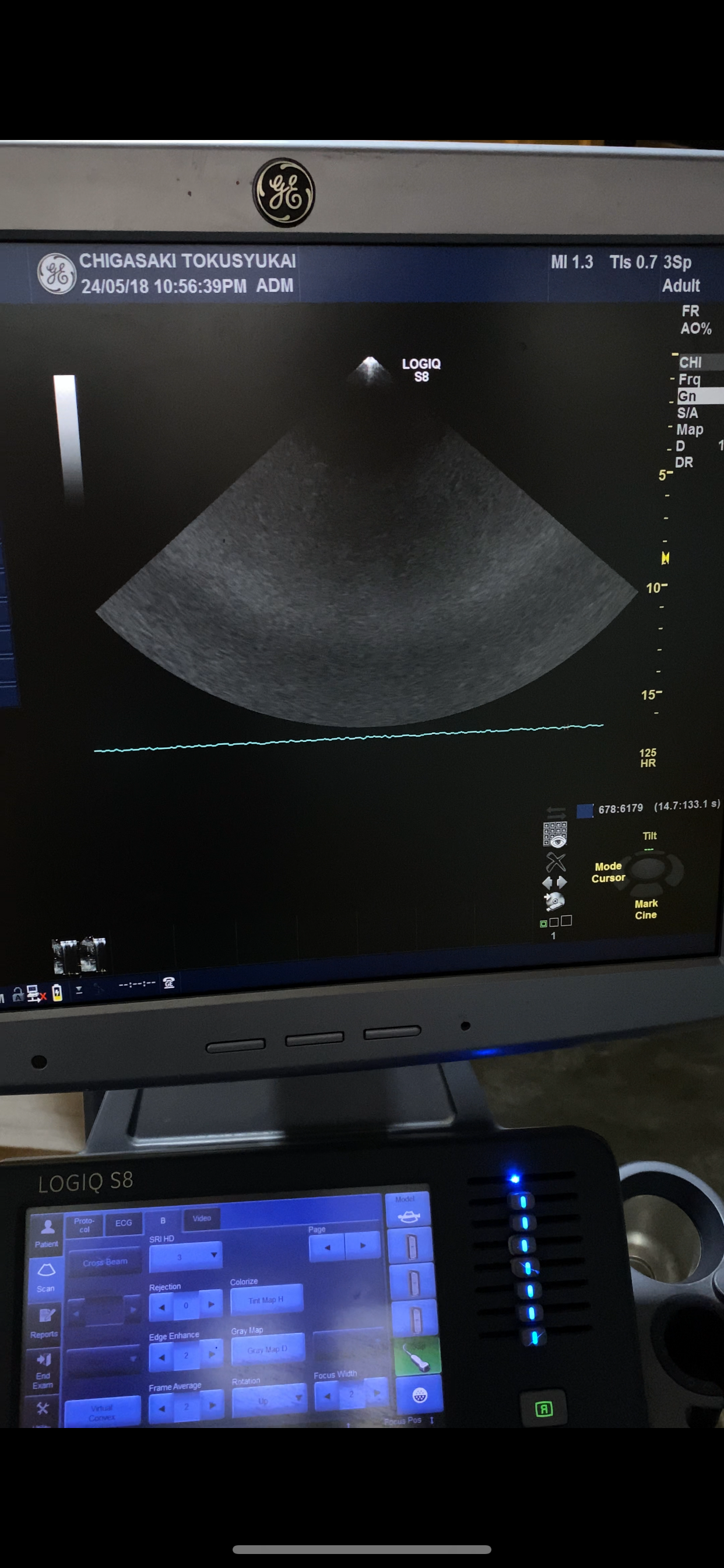 …GE 3SP-D cardiac probe