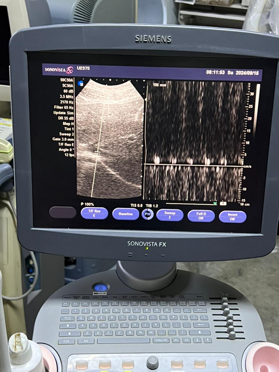 Sonovista fx black and white ultrasound CONVEX TVS probr