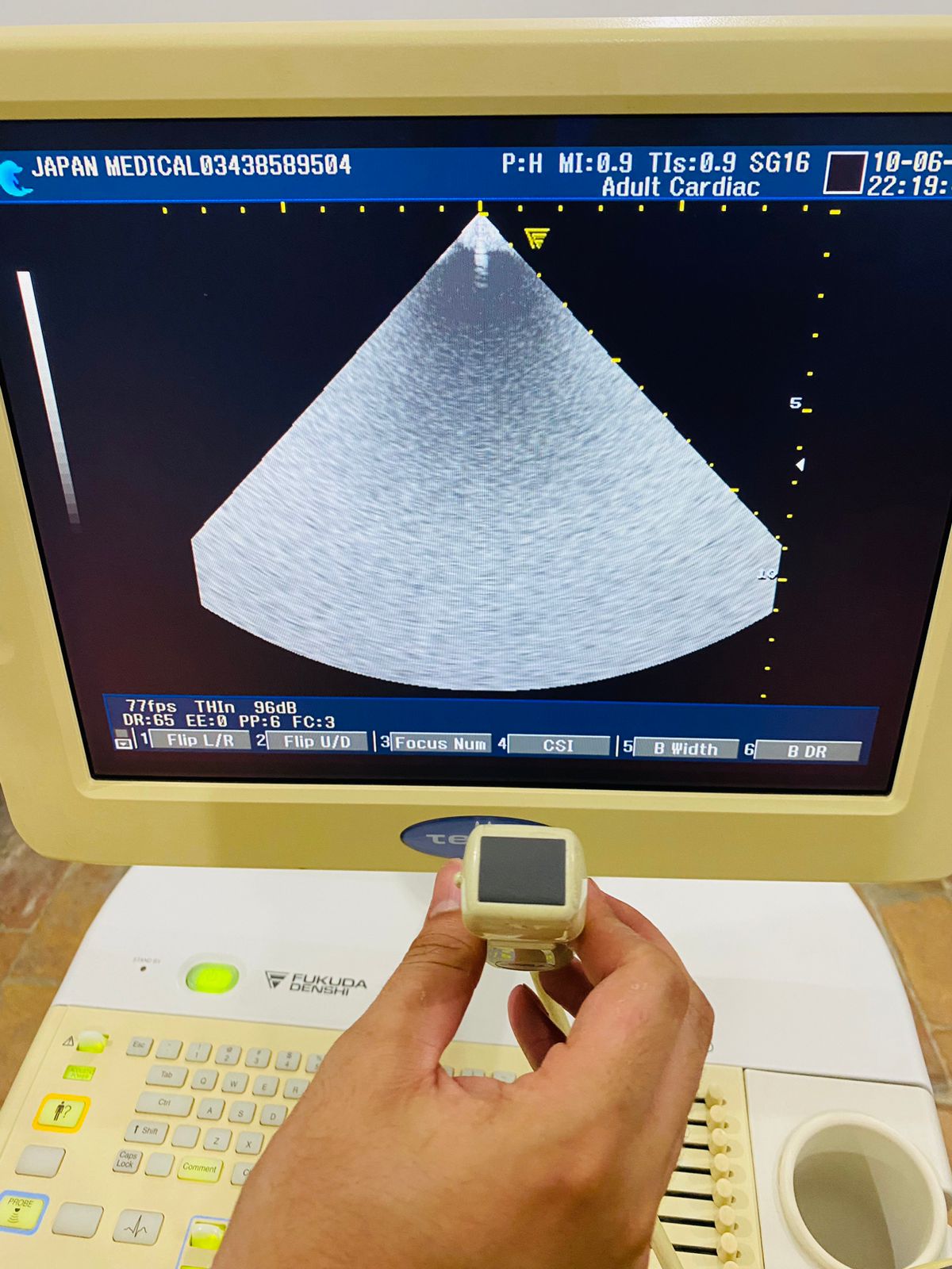 Z…Fukuda Denshi 2-5 cardiac probe