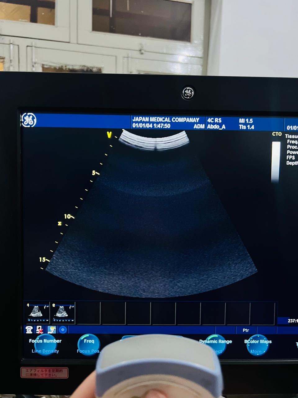 ..GE 4C RS Probe Num 7