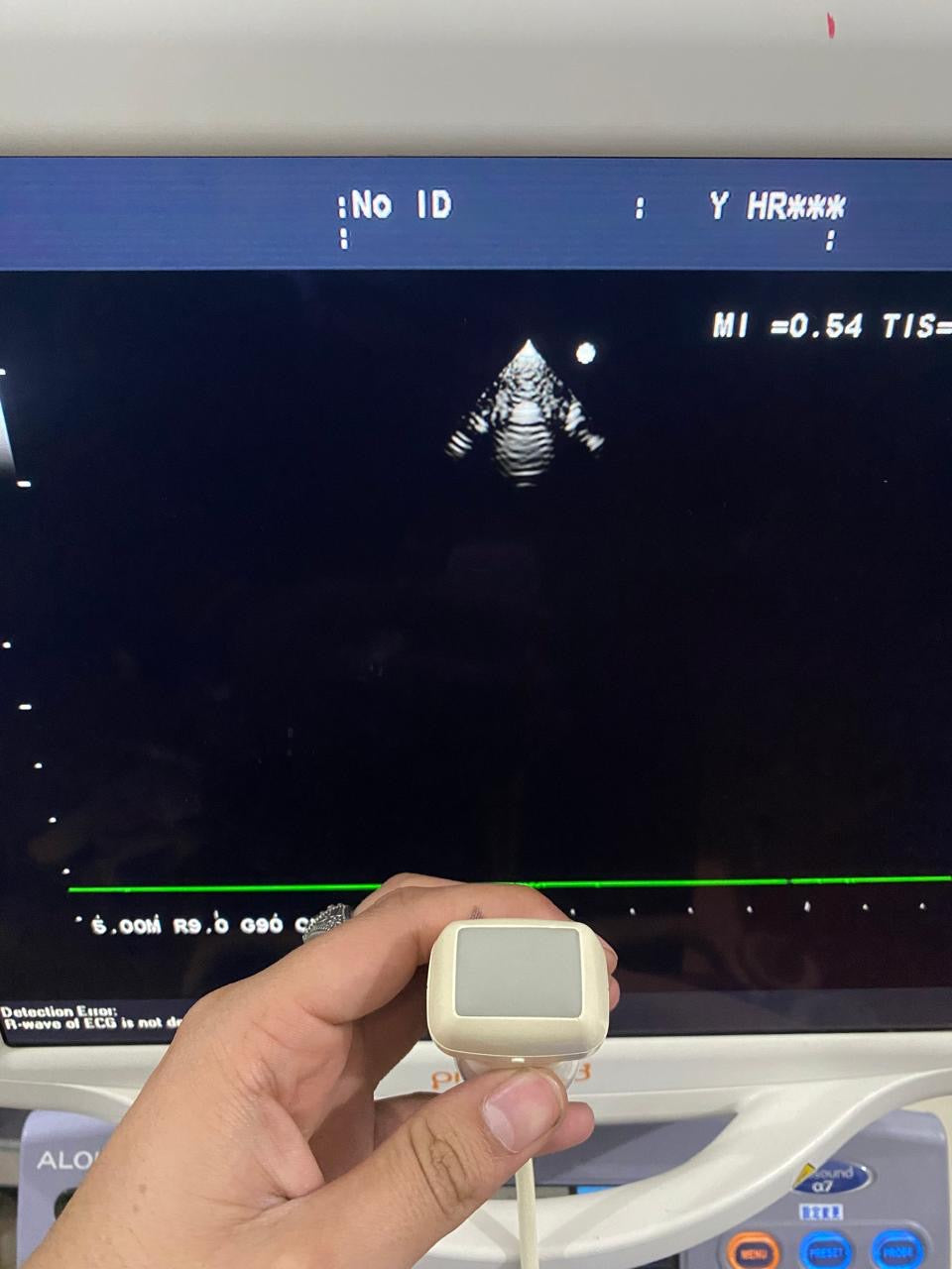 ..Aloka UST-52105 cardiac probe