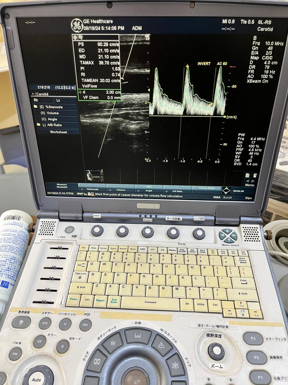 ..GE 8L-RS linear probe