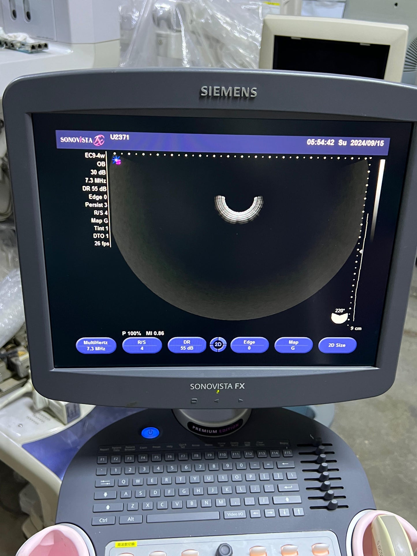Sonovista FX Premium edition black and white ultrasound with convex tvs probe