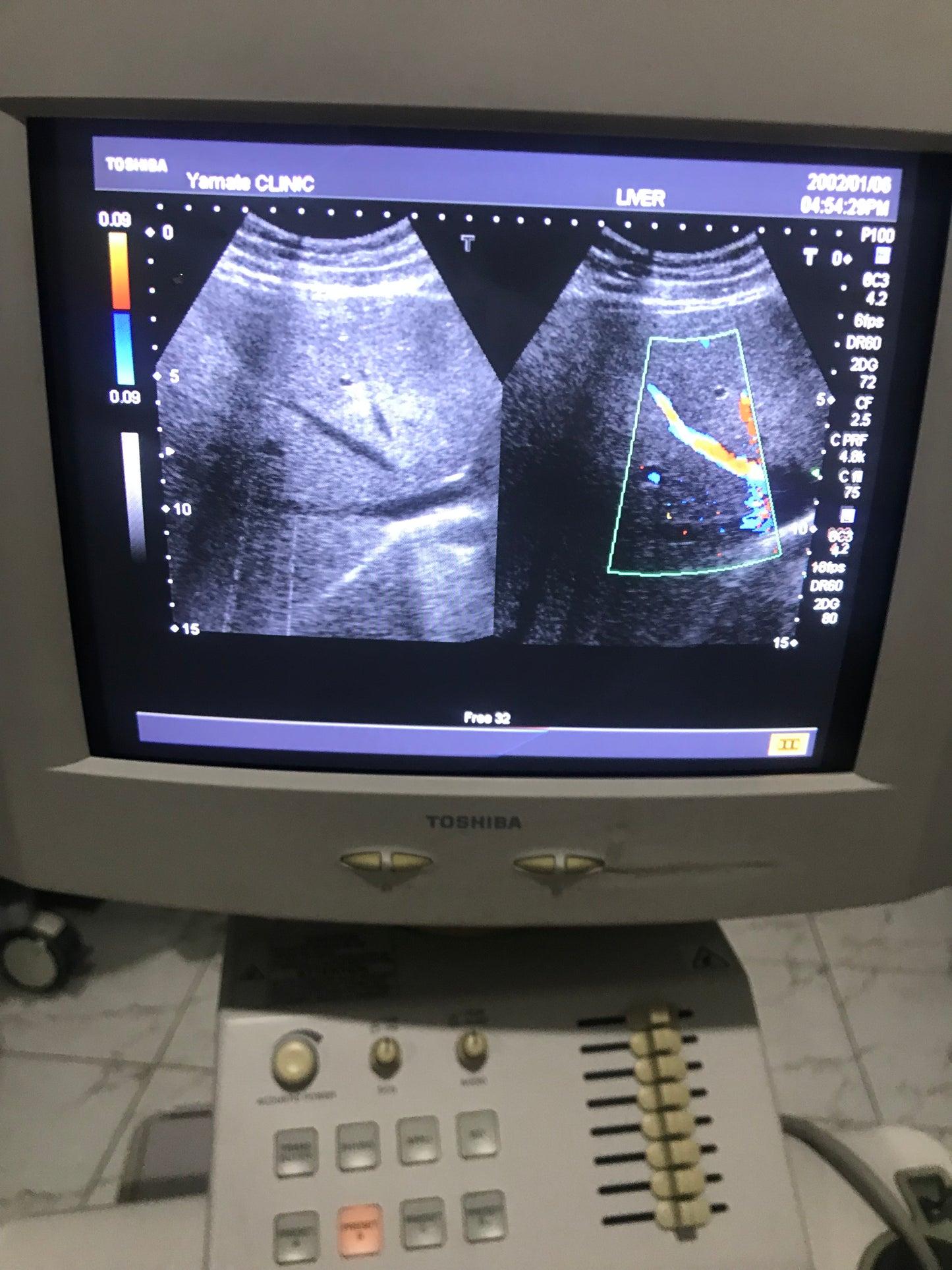 ..Toshiba PVM-375AT canvex probe - Japan Medical Company LTD