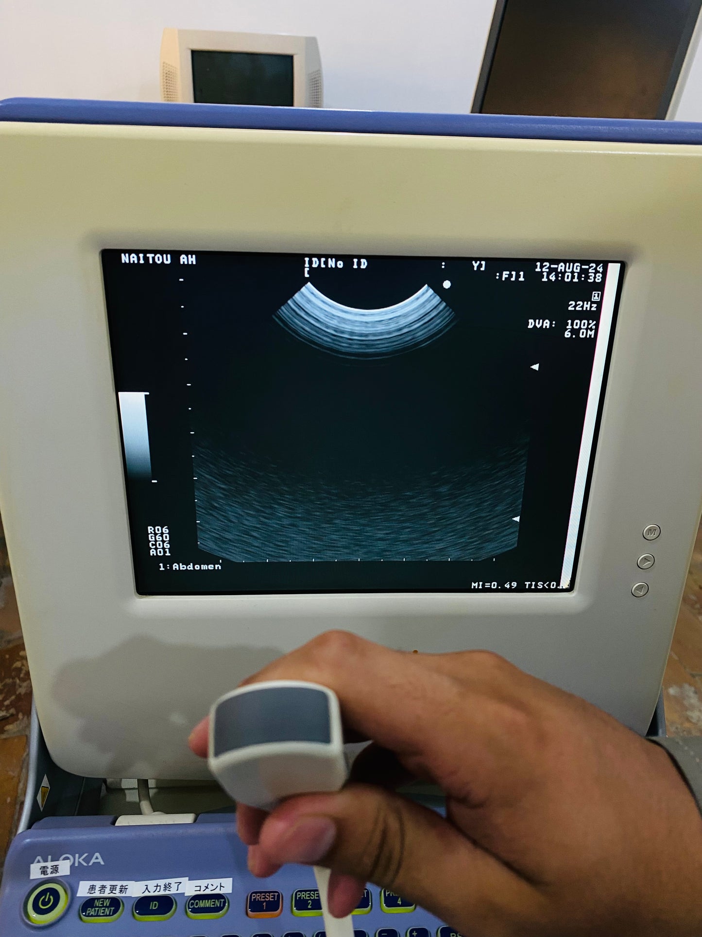 P..Aloka UST-9111-5 Micro convex probe