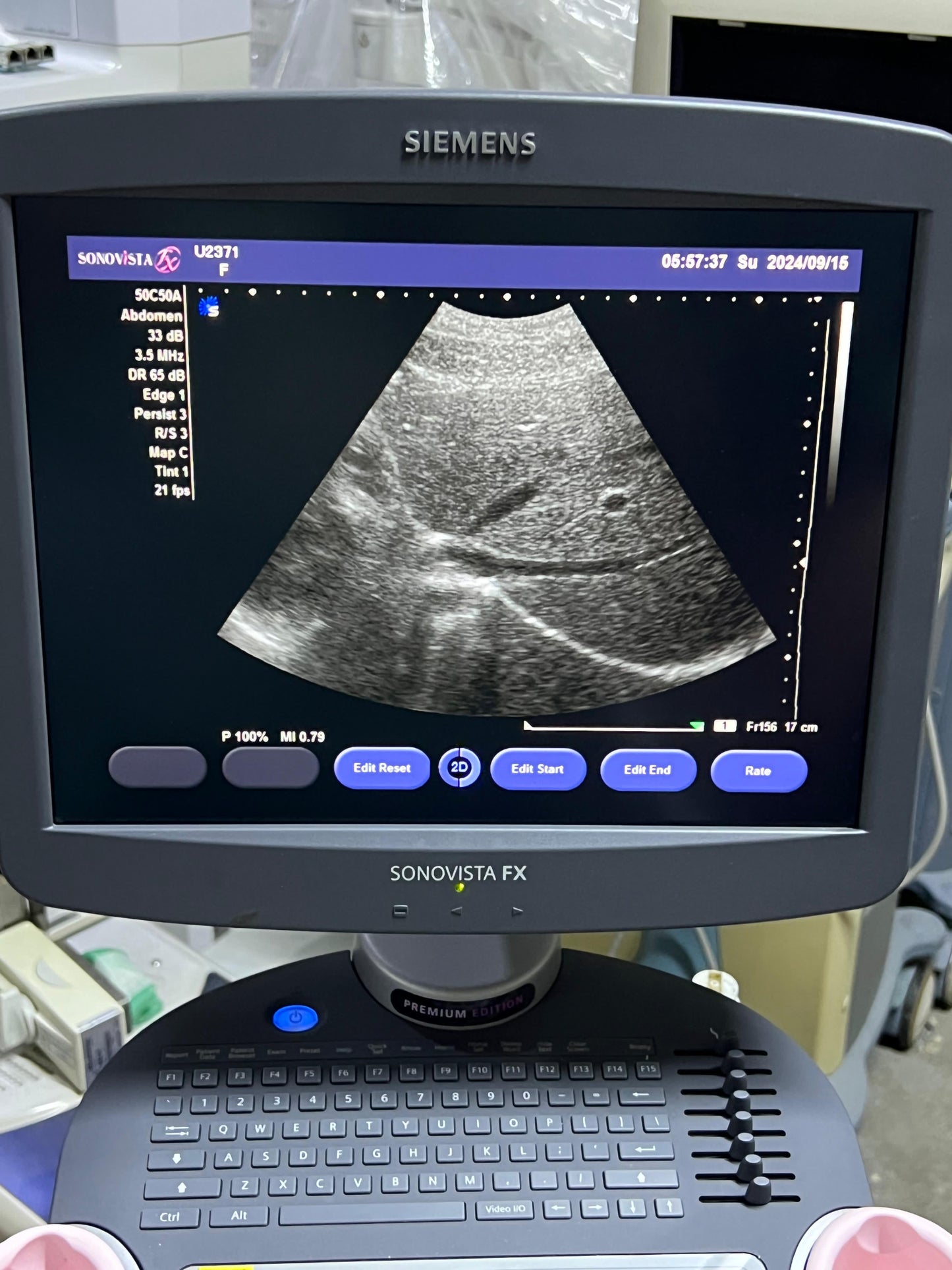 Sonovista FX Premium edition black and white ultrasound with convex tvs probe