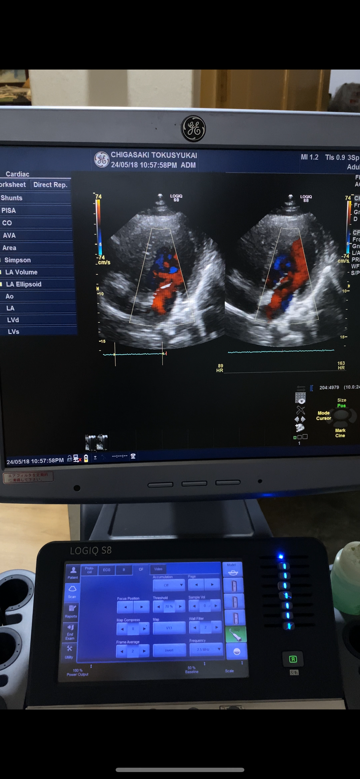 …GE 3SP-D cardiac probe