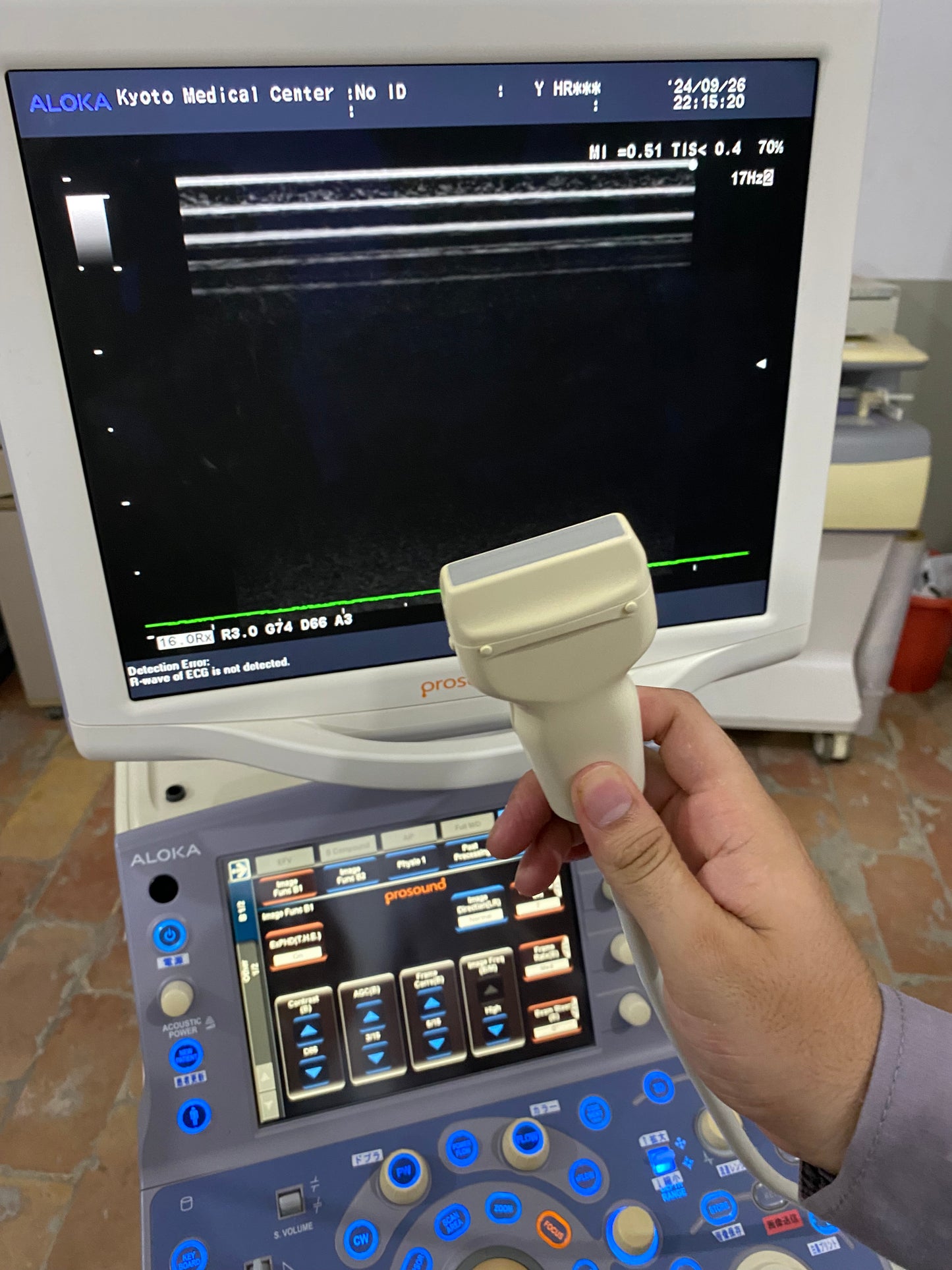 P..Aloka UST-5412 linear probe