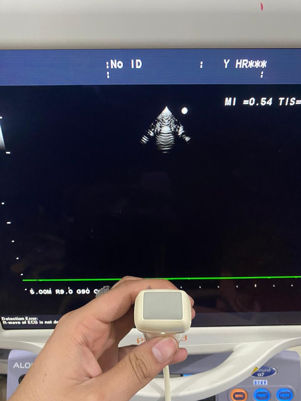 ..Aloka UST-52105 cardiac probe