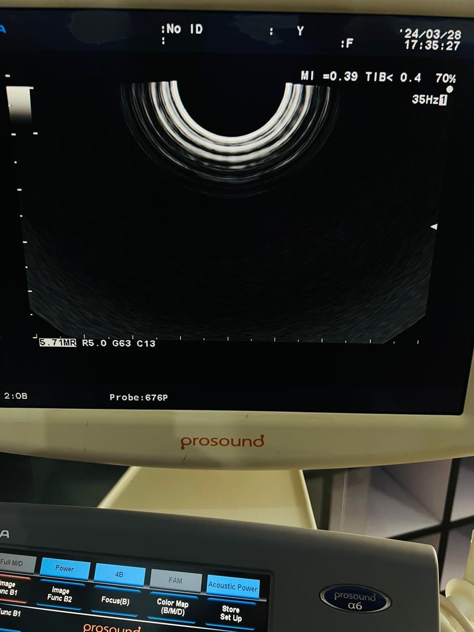..Aloka UST-676P TVs probe checked dxb