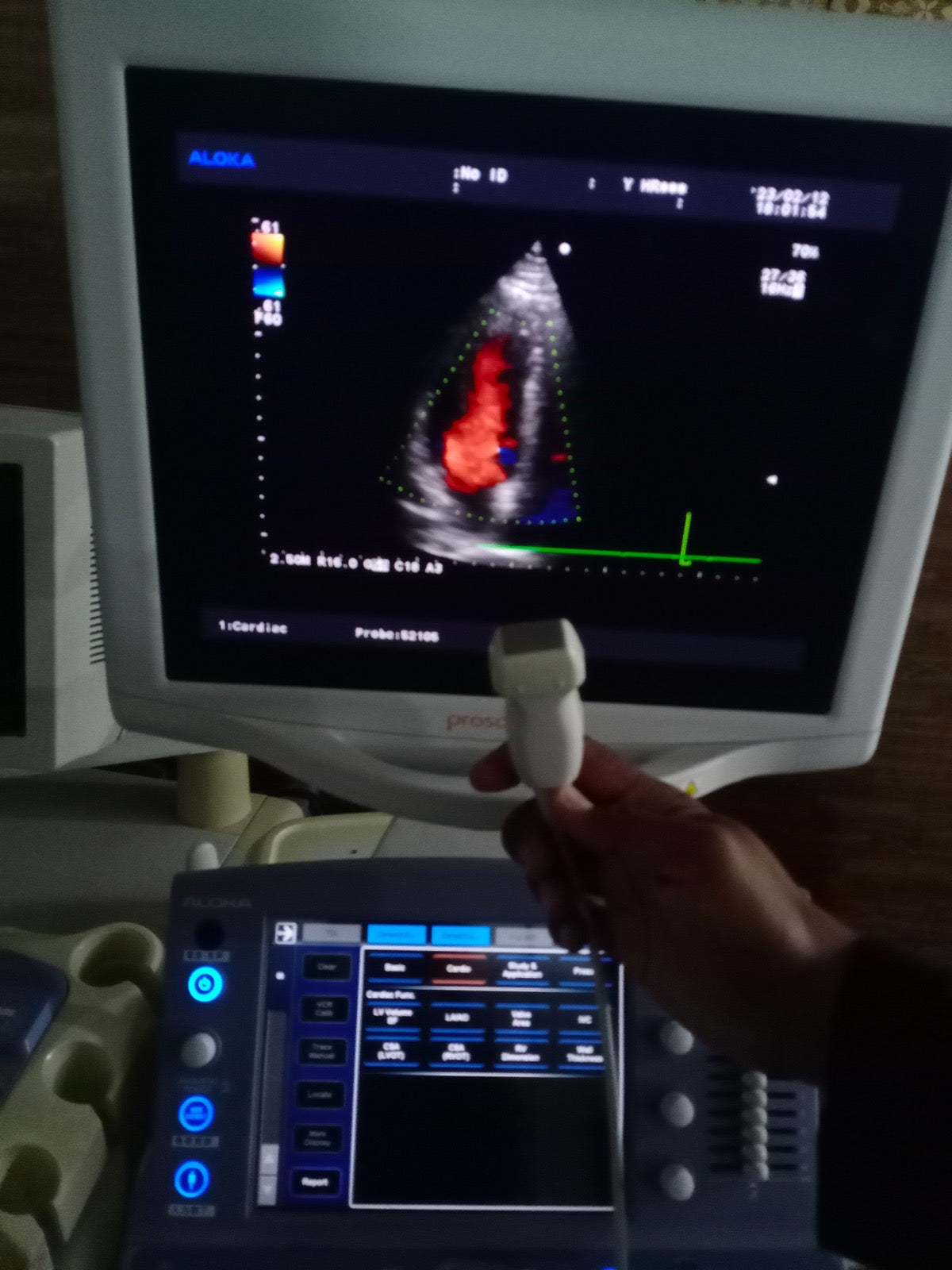 ..Aloka UST-52105 cardiac probe - Japan Medical Company LTD