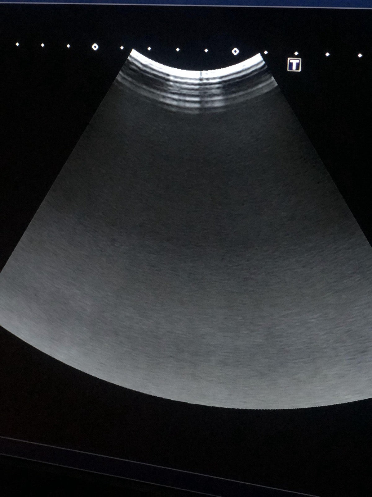 Toshiba PVI-574BX Canvex array probe - Japan Medical Company LTD