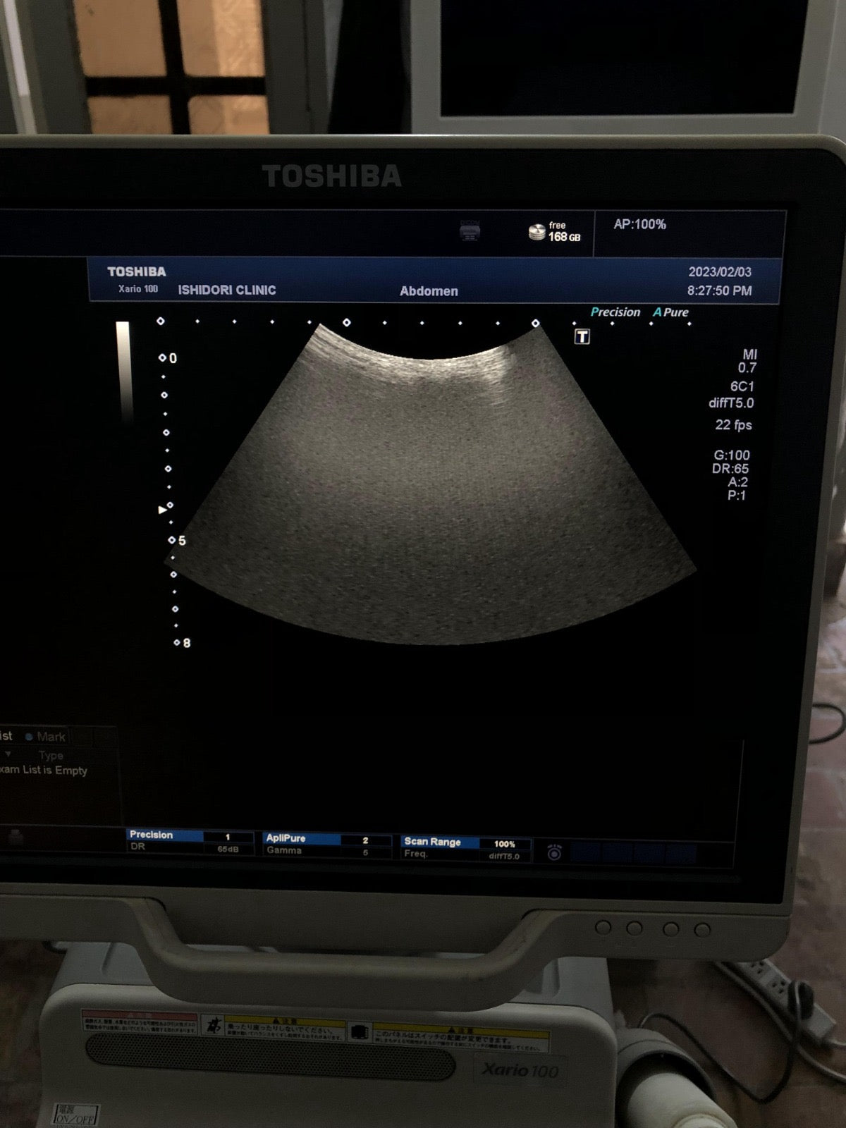 Toshiba PVU-375BT canvex probe - Japan Medical Company LTD