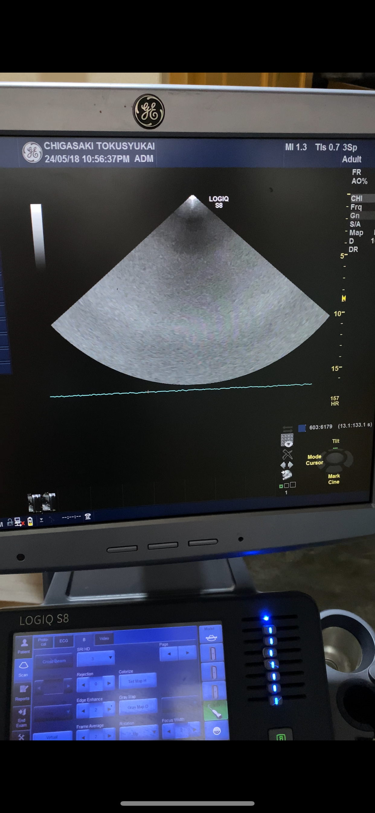 …GE 3SP-D cardiac probe