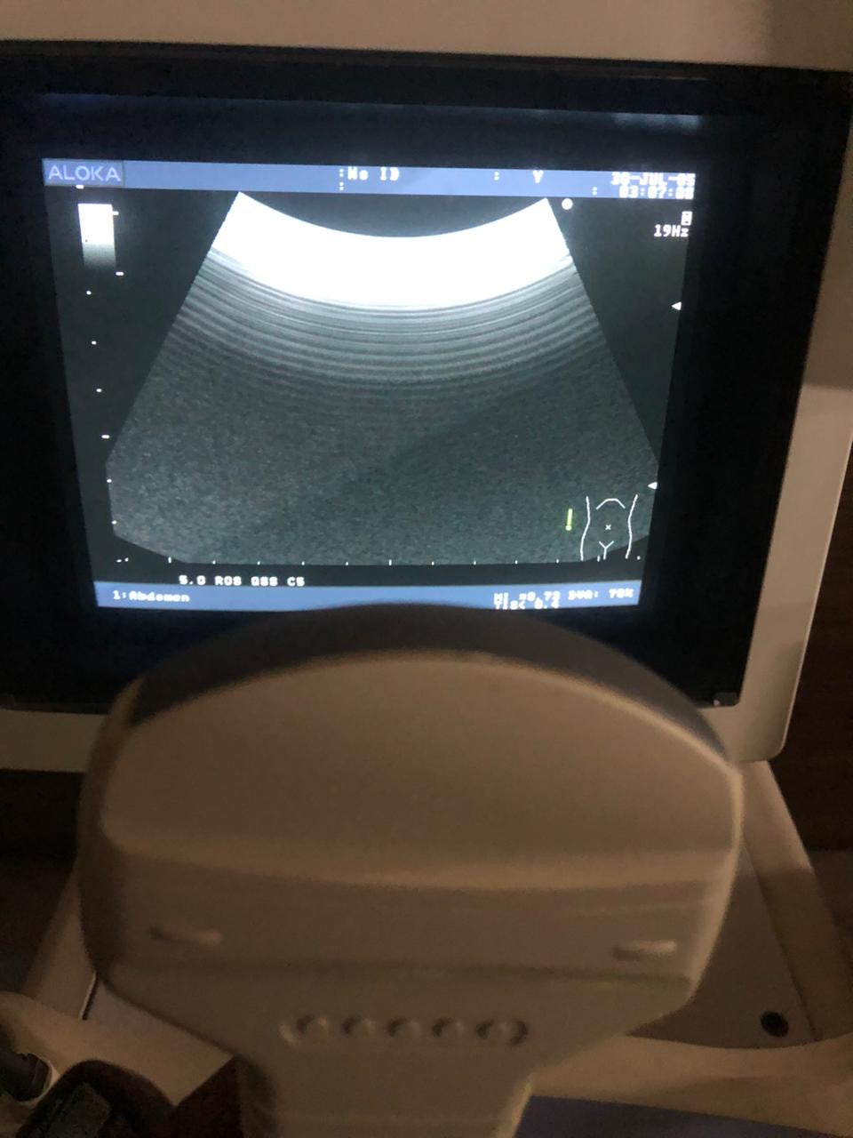..Aloka UST-9126 Convex Probe - Japan Medical Company LTD