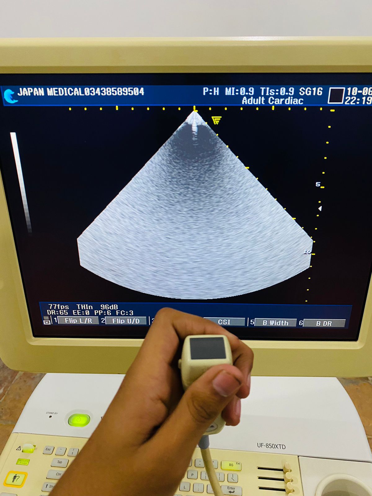 Z…Fukuda Denshi 2-5 cardiac probe