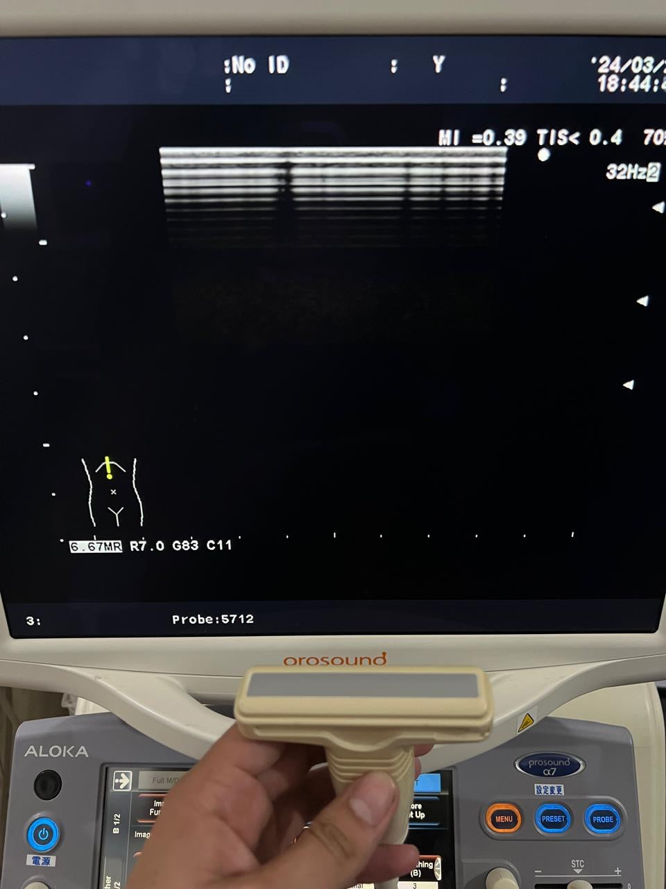 ..Hitachi UST-5712 linear vascular probe - Japan Medical Company LTD
