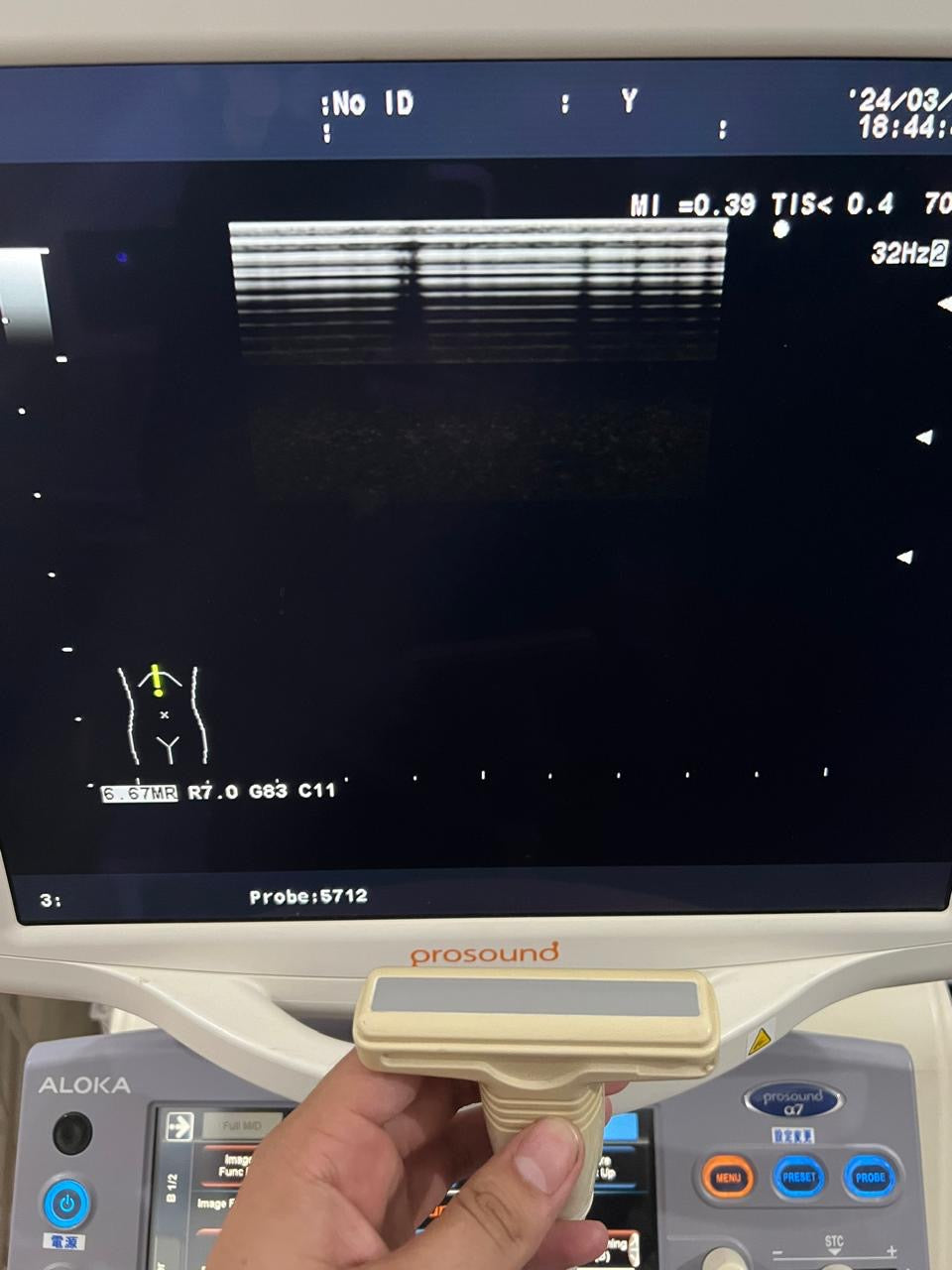 ..Hitachi UST-5712 linear vascular probe - Japan Medical Company LTD