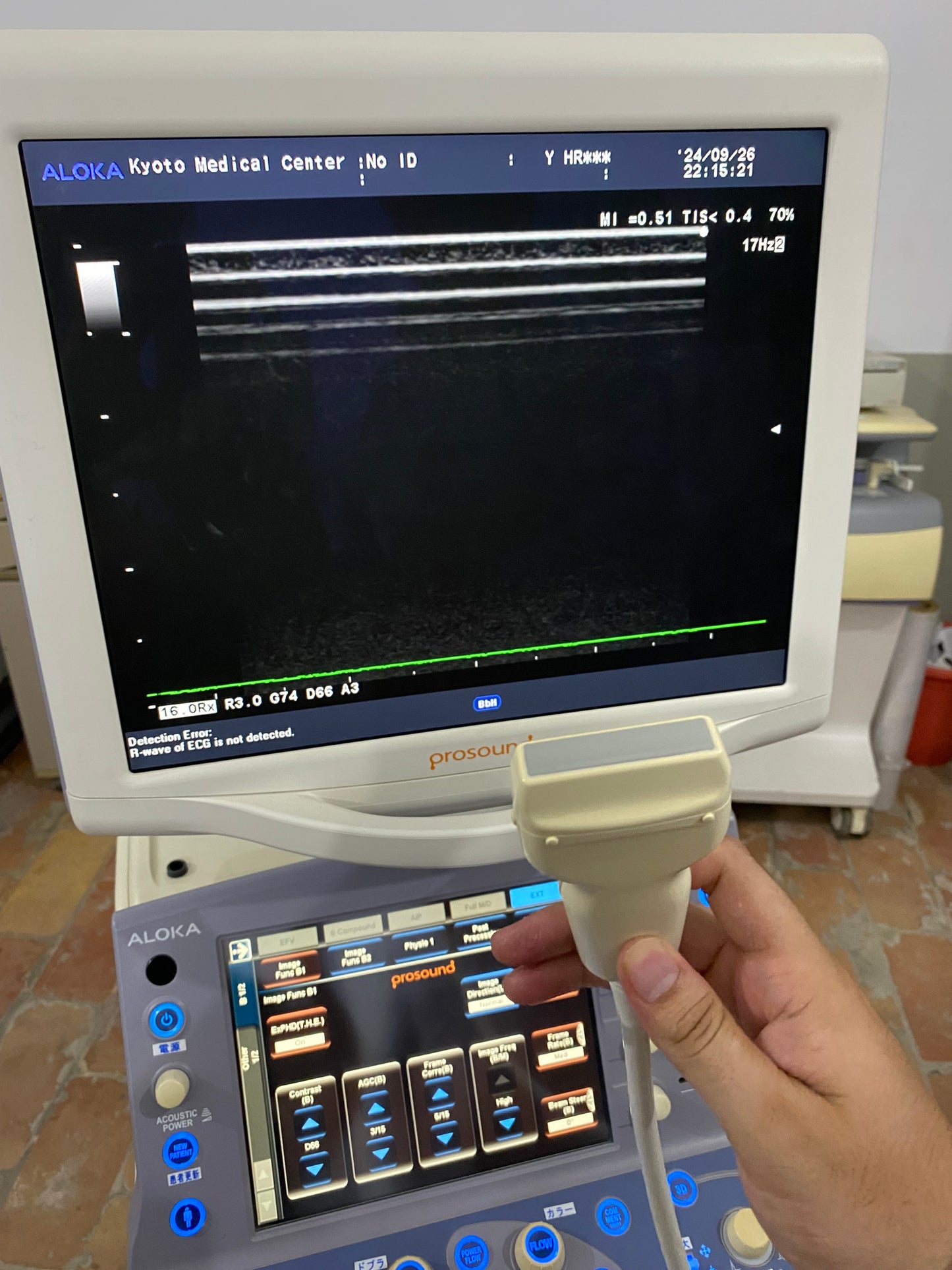 P..Aloka UST-5412 linear probe