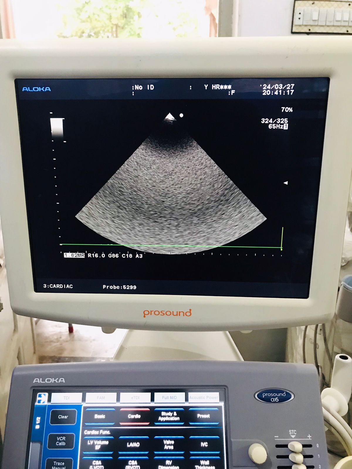 Z..Aloka UST-5299 Cardiac Probe checked dxb
