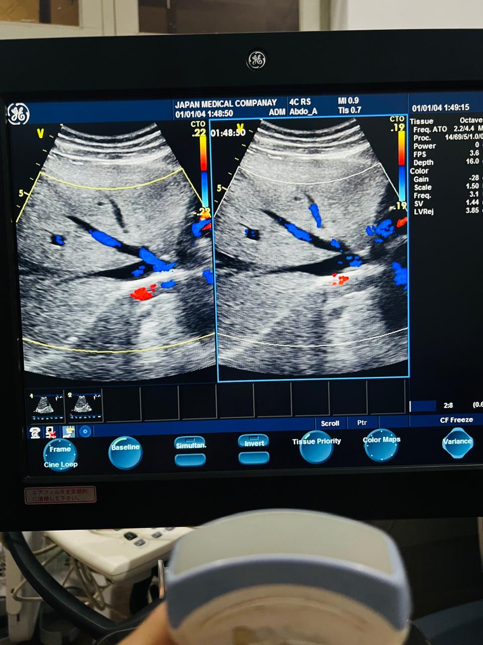 ..GE 4C RS Probe Num 7