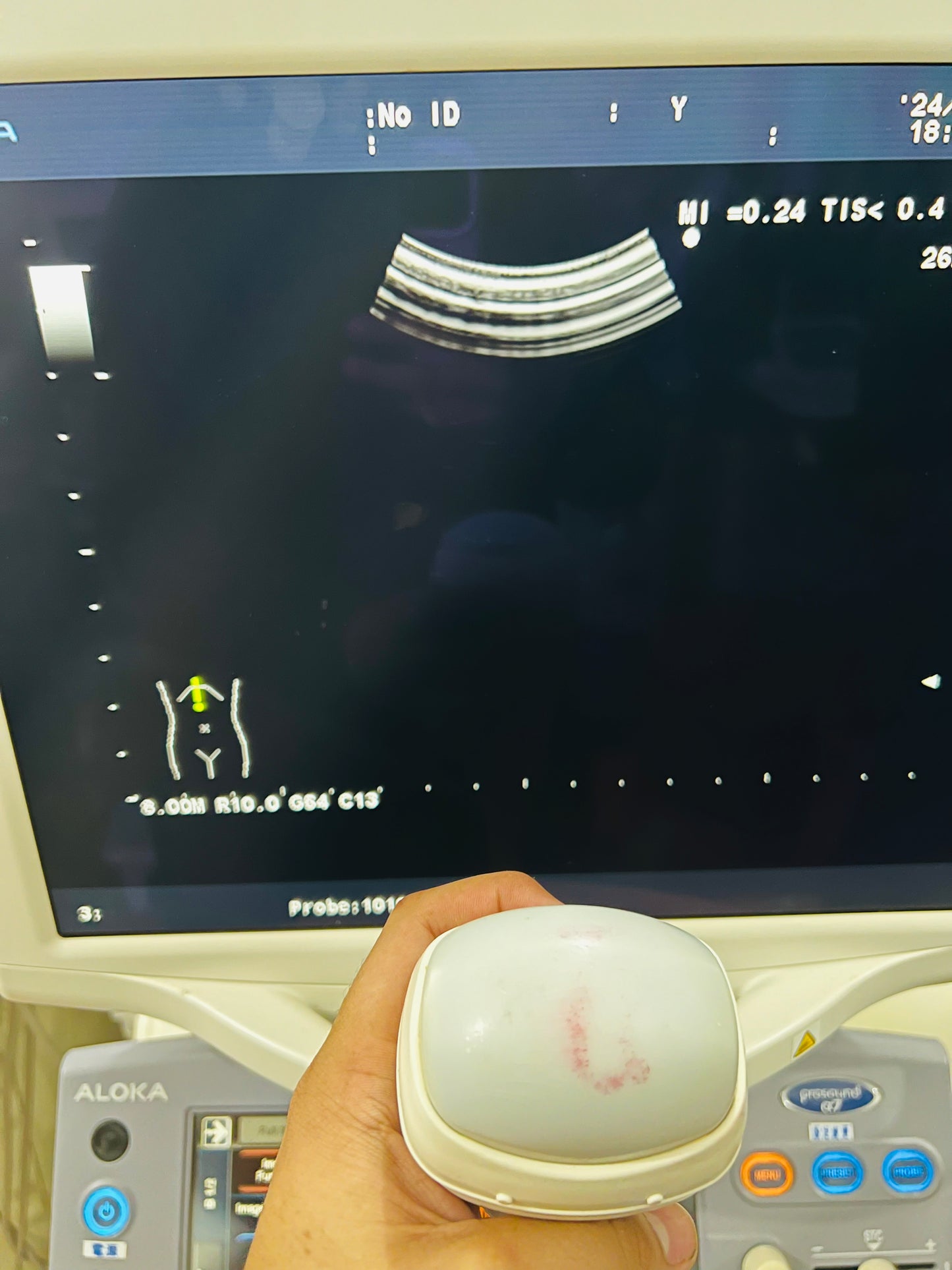 ..Aloka UST-1010 4D probe