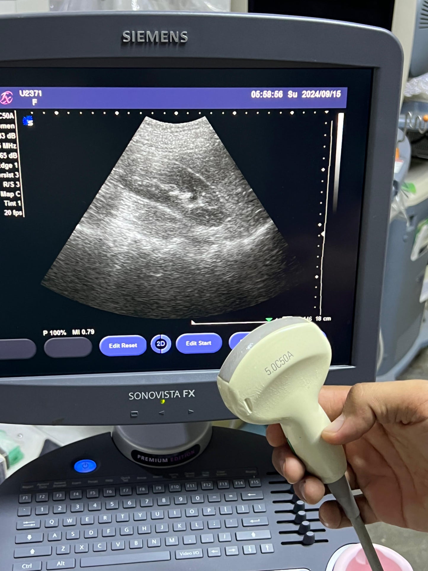 Sonovista FX Premium edition black and white ultrasound with convex tvs probe